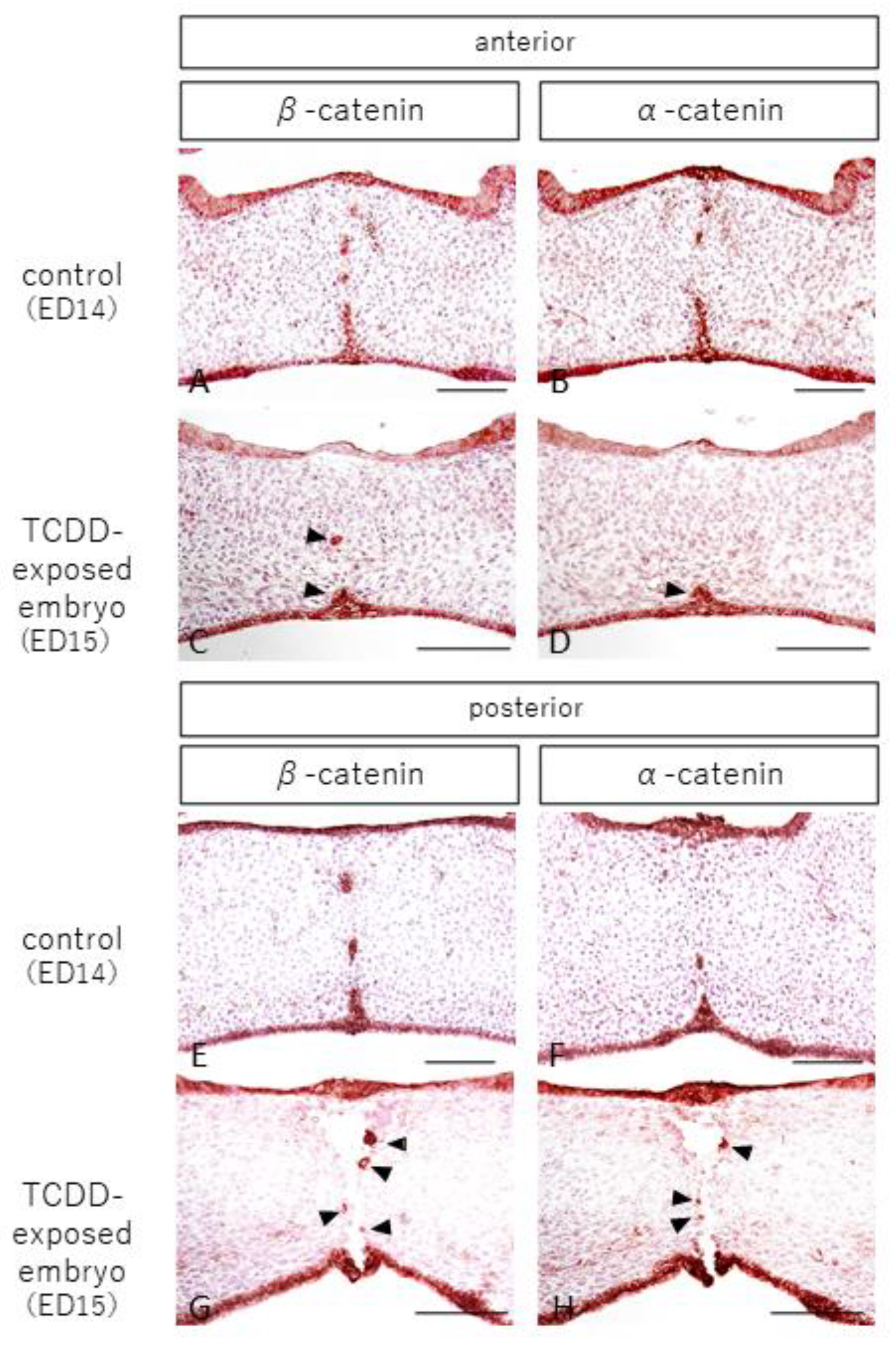 Ijms 23 02069 g003 550