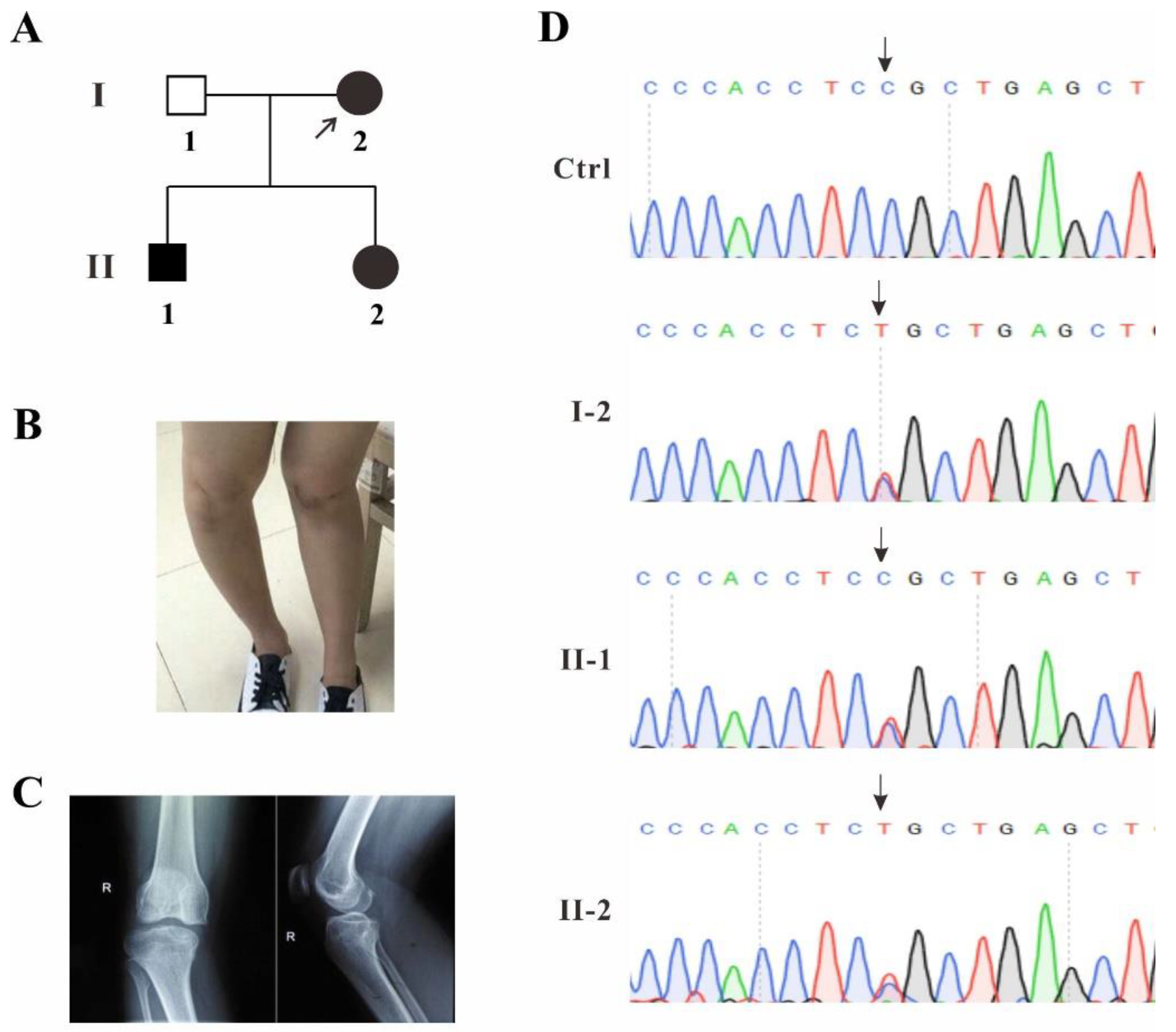 Identification and Functional Evaluation of a Novel TBX4