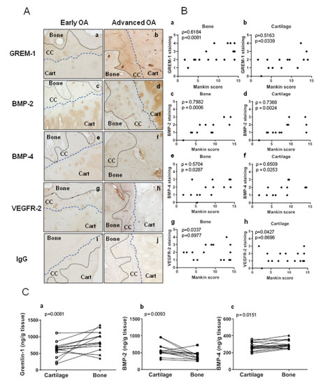 PDF) Excessive mechanical loading promotes osteoarthritis through