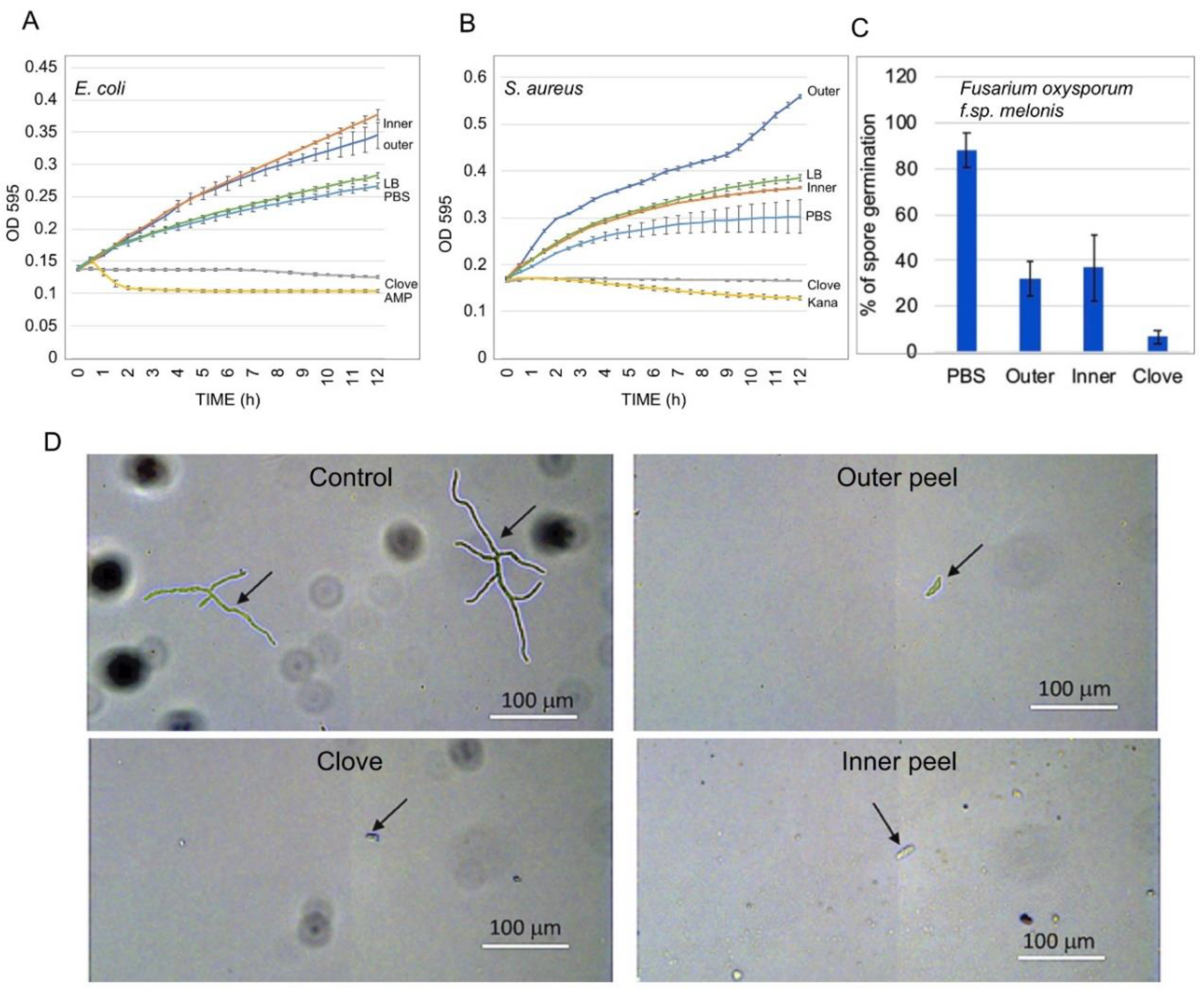 Ijms 23 02126 g007 550