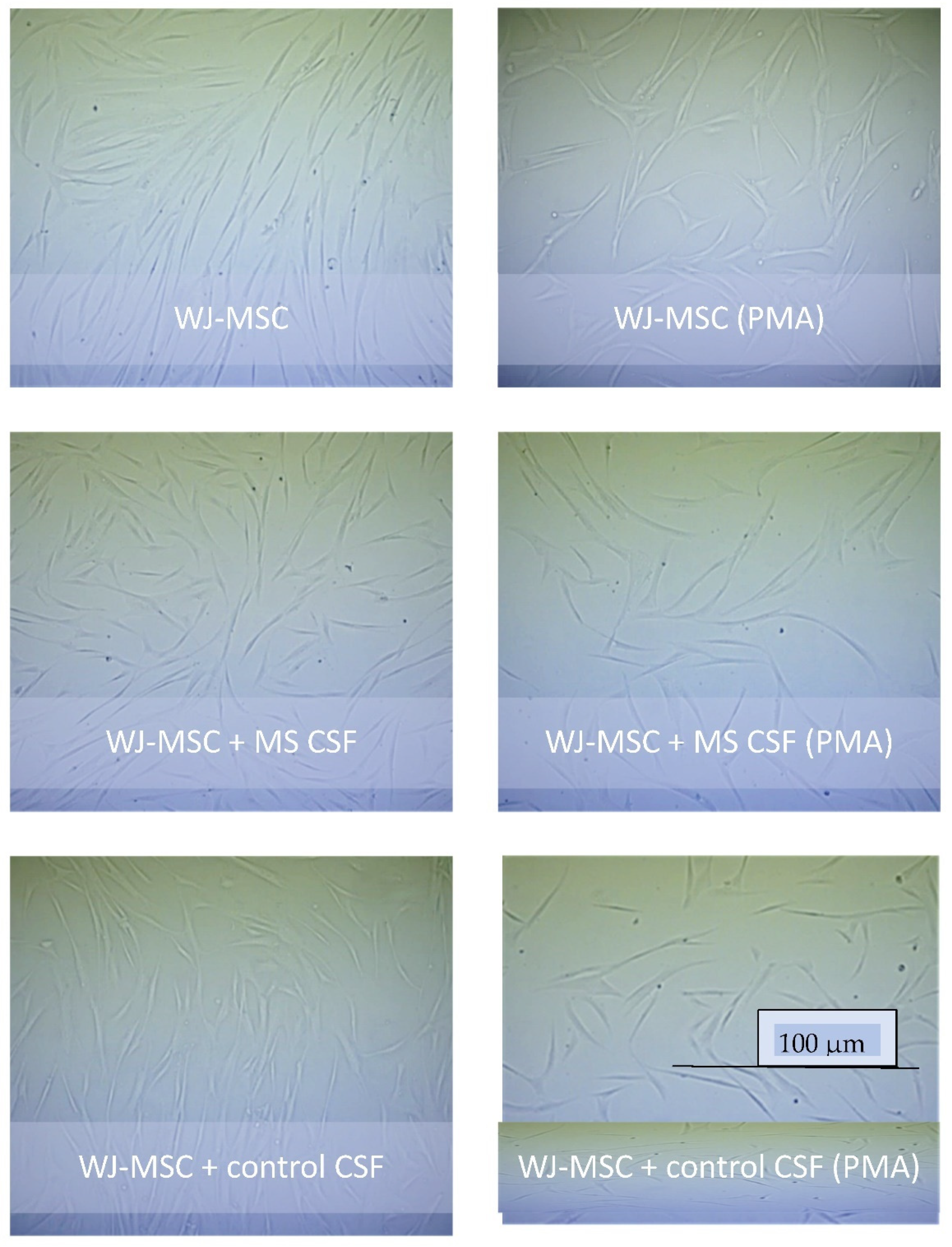 Ijms 23 02177 g001 550