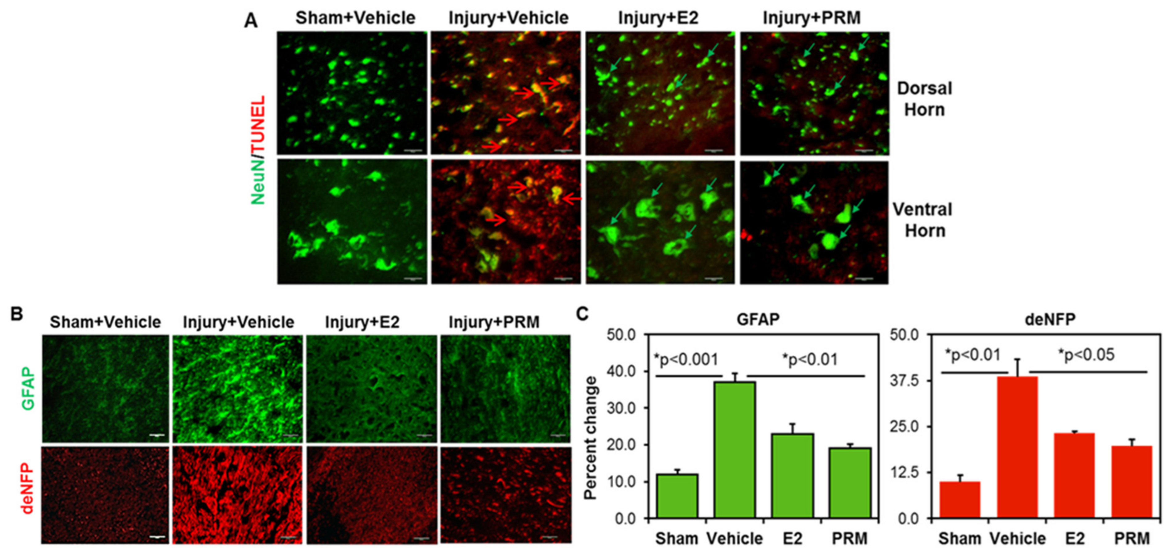 Ijms 23 02384 g004 Ijms 23 02384 g004
