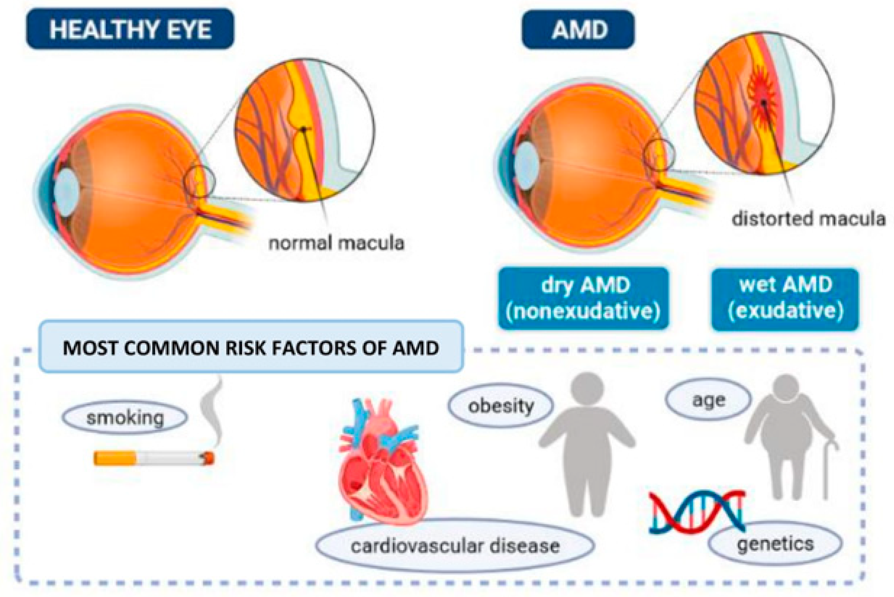 Exudative Versus Nonexudative Age