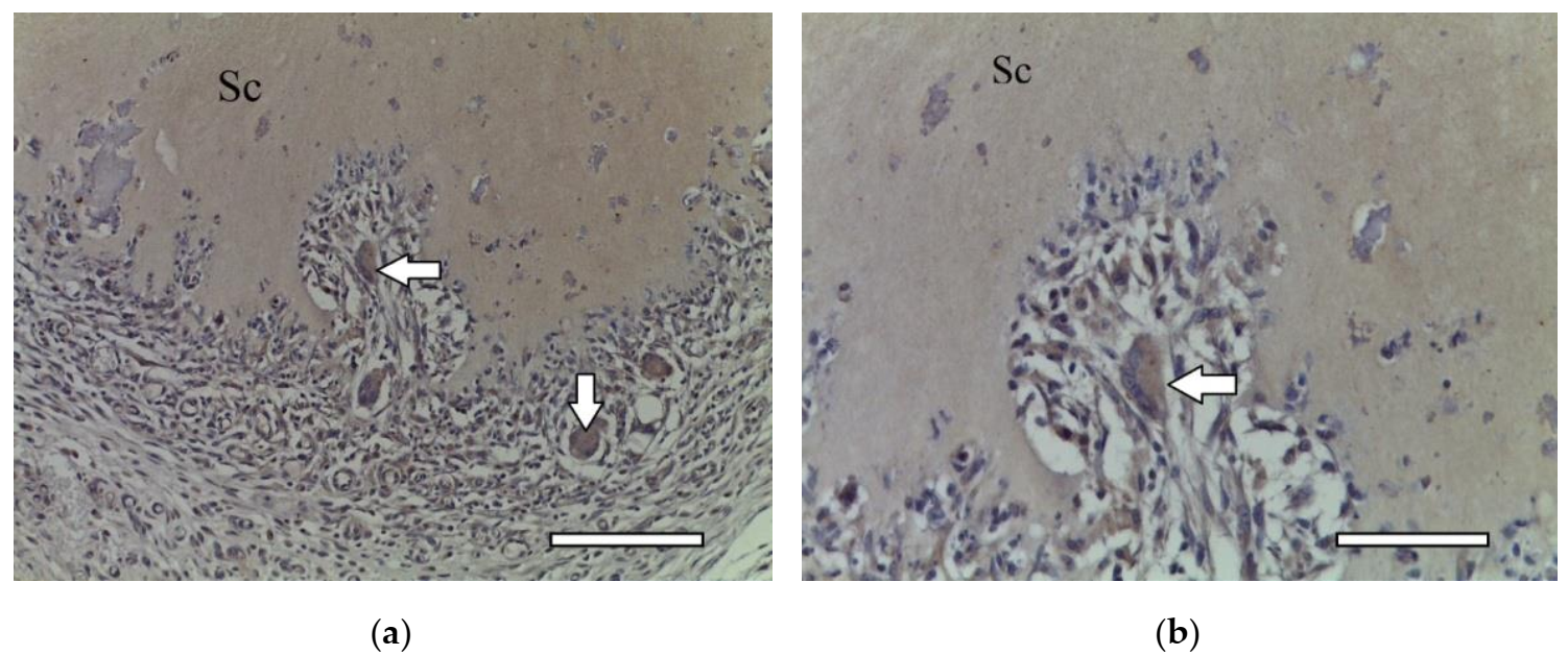 Ijms 23 02703 g011 Ijms 23 02703 g011