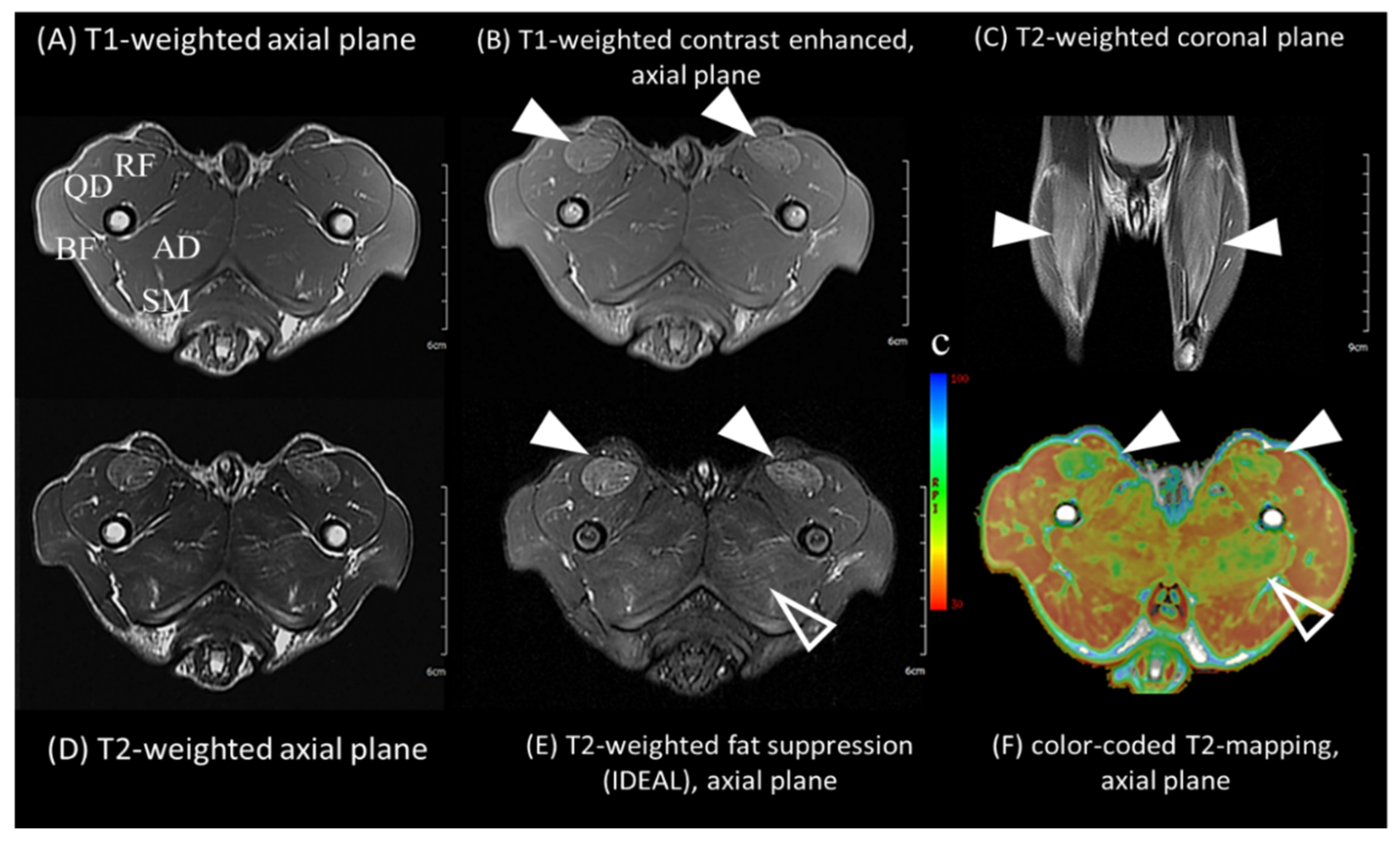 Ijms 23 02898 g002 550