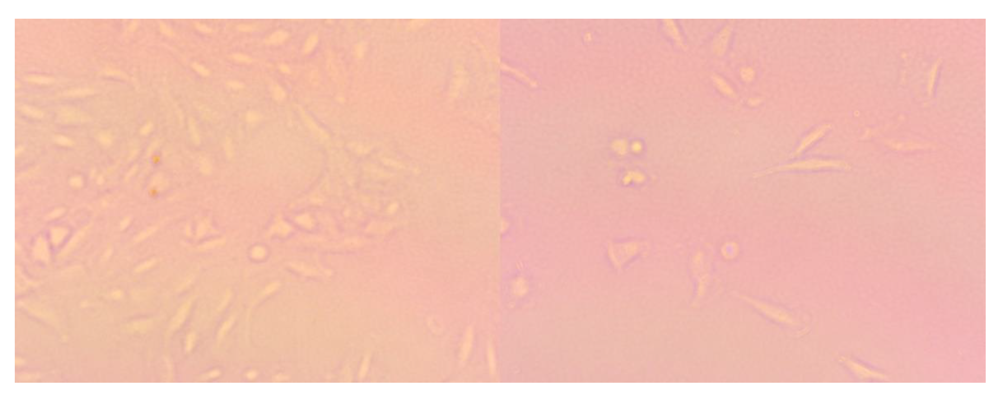 Ijms 23 02980 g015 550