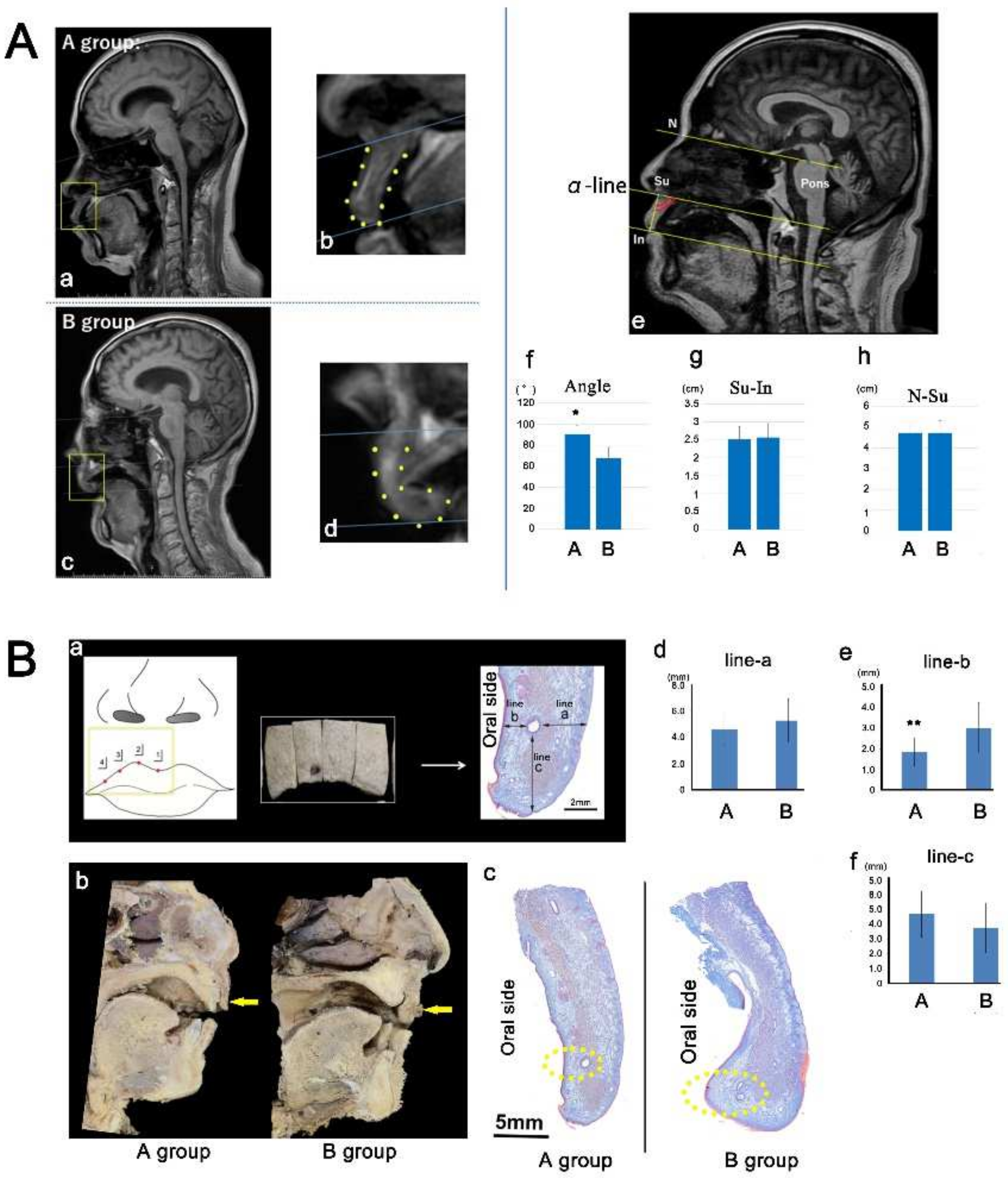 Alteration of Oral and Perioral Soft Tissue in Mice Alteration of Oral and Perioral Soft Tissue in Mice