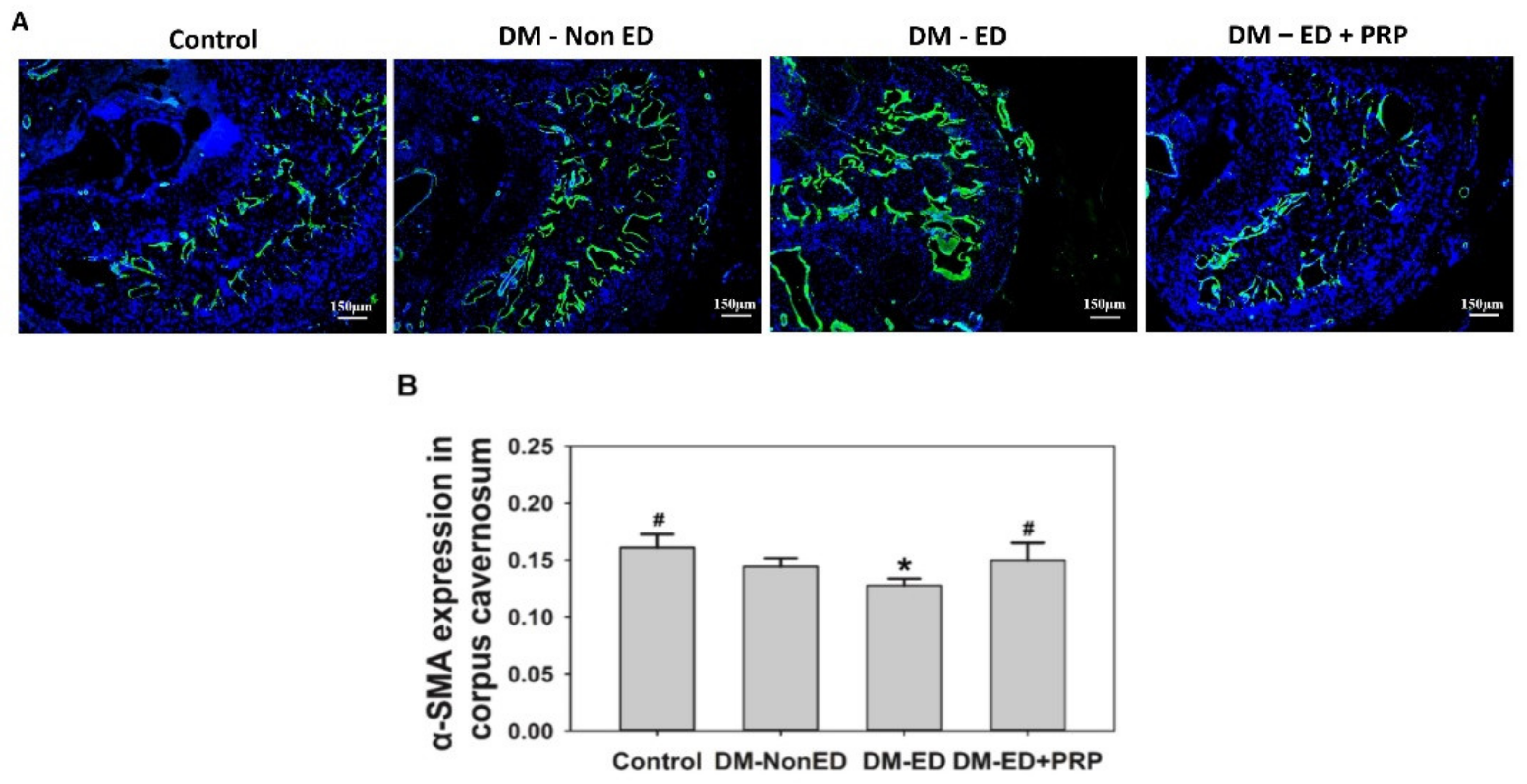 Ijms 23 03017 g007 Ijms 23 03017 g007