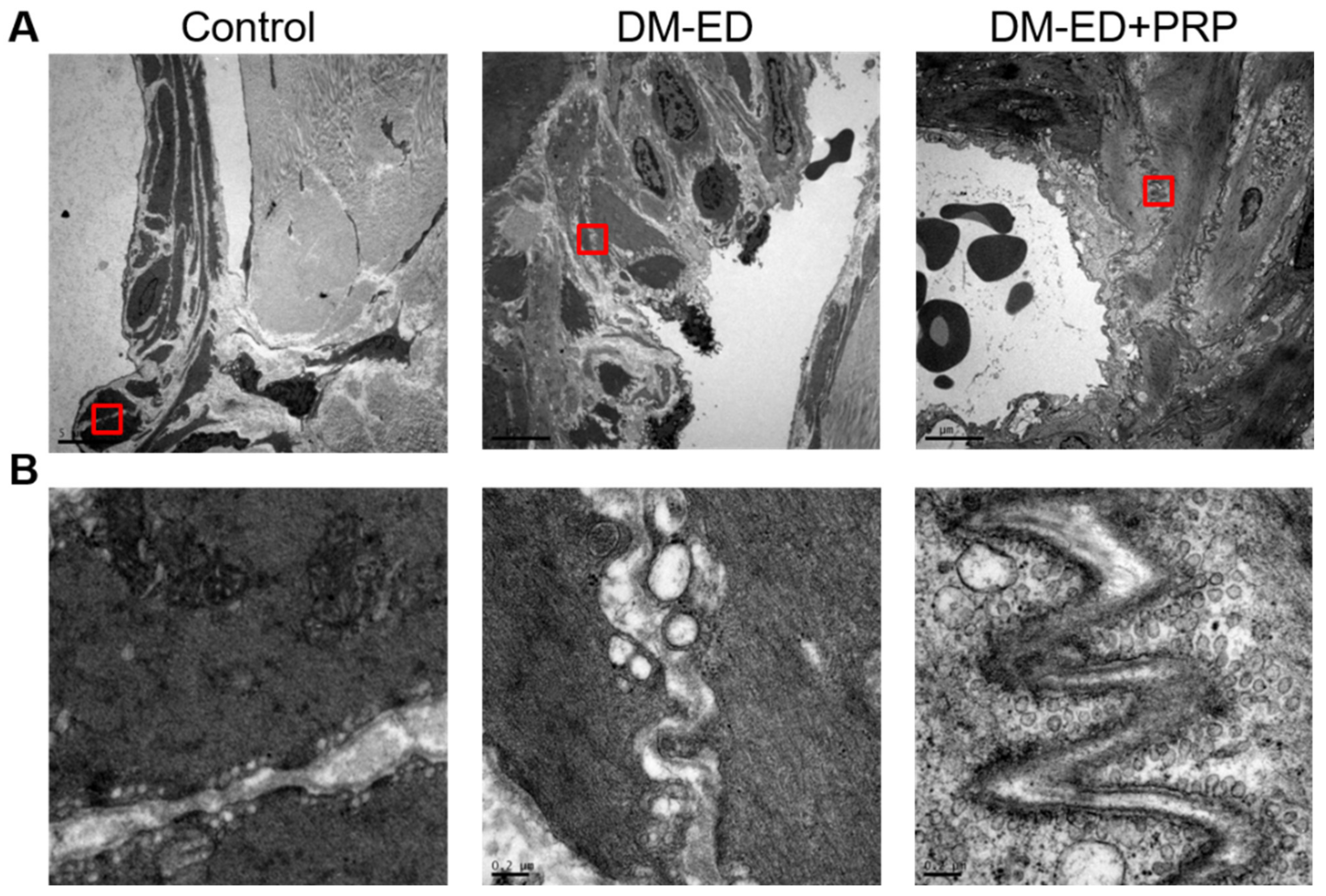 Ijms 23 03017 g008 Ijms 23 03017 g008