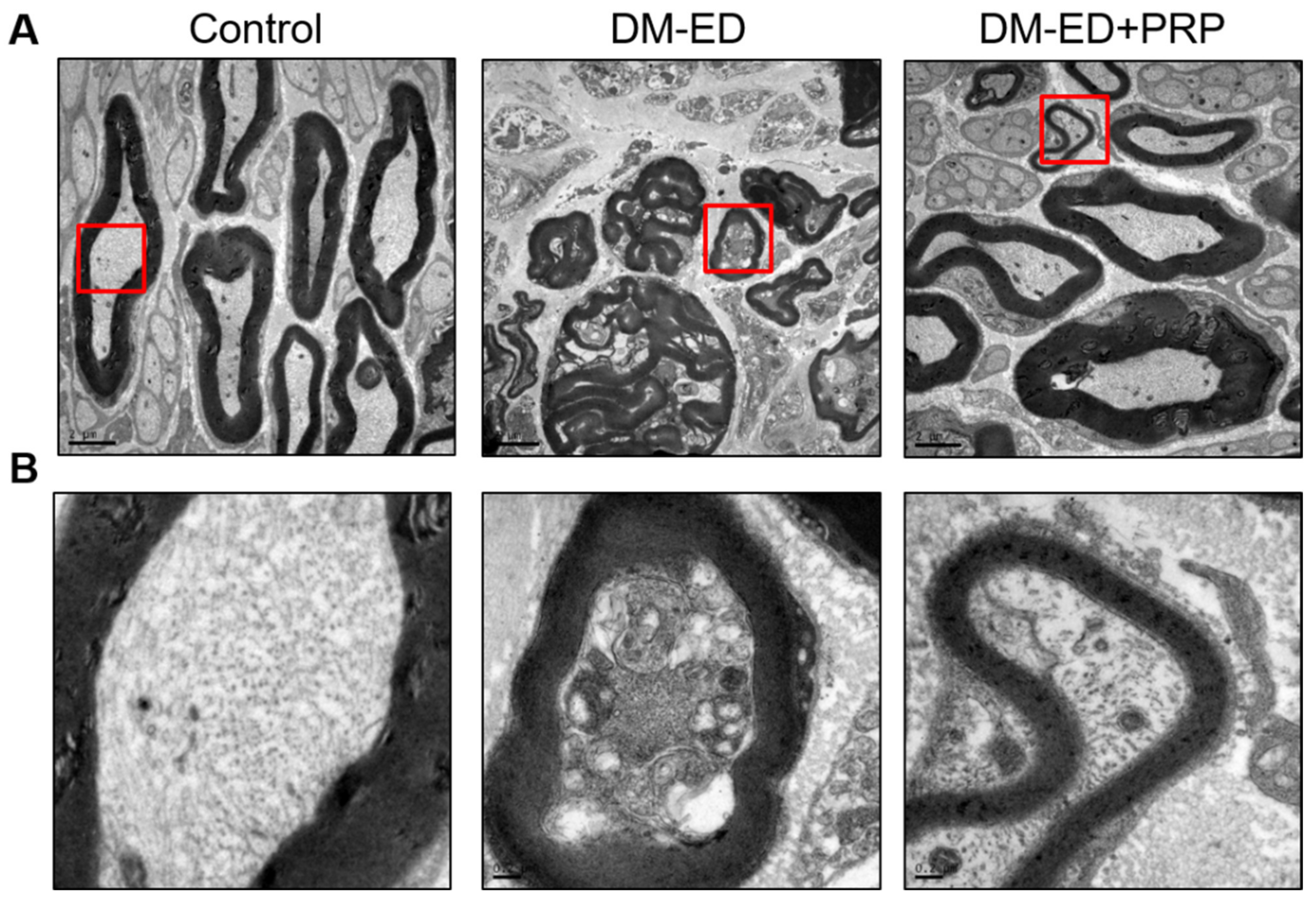 Ijms 23 03017 g009 Ijms 23 03017 g009