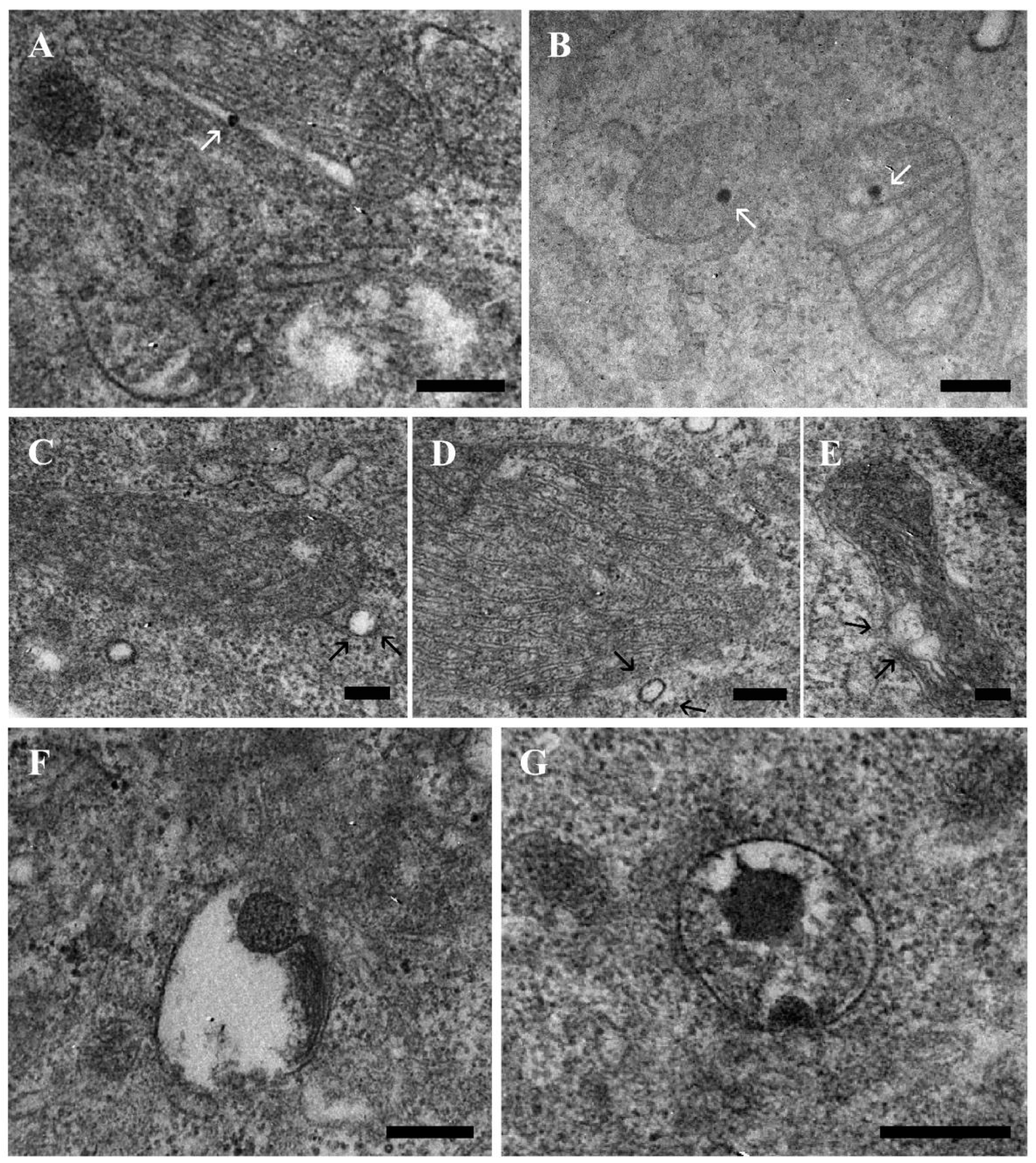 Ijms 23 03069 g004 550