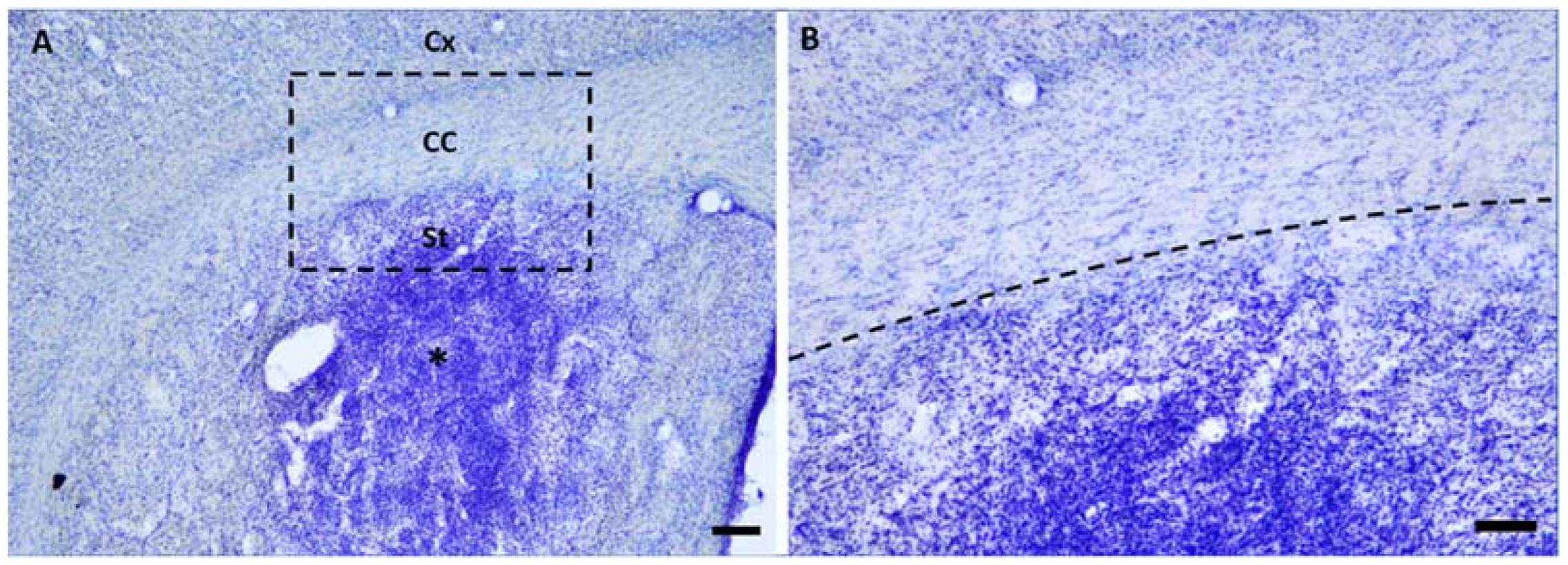 Ijms 23 03179 g001 550