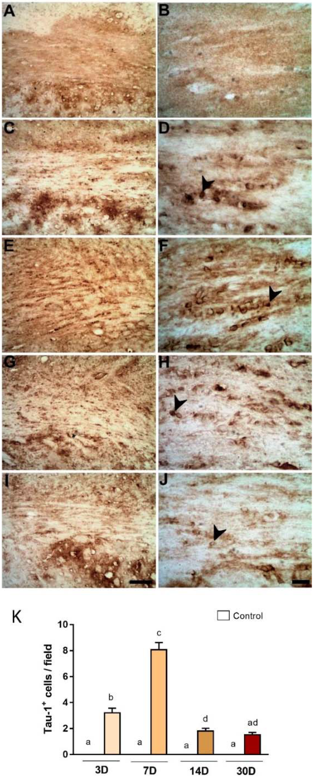 Ijms 23 03179 g004 550