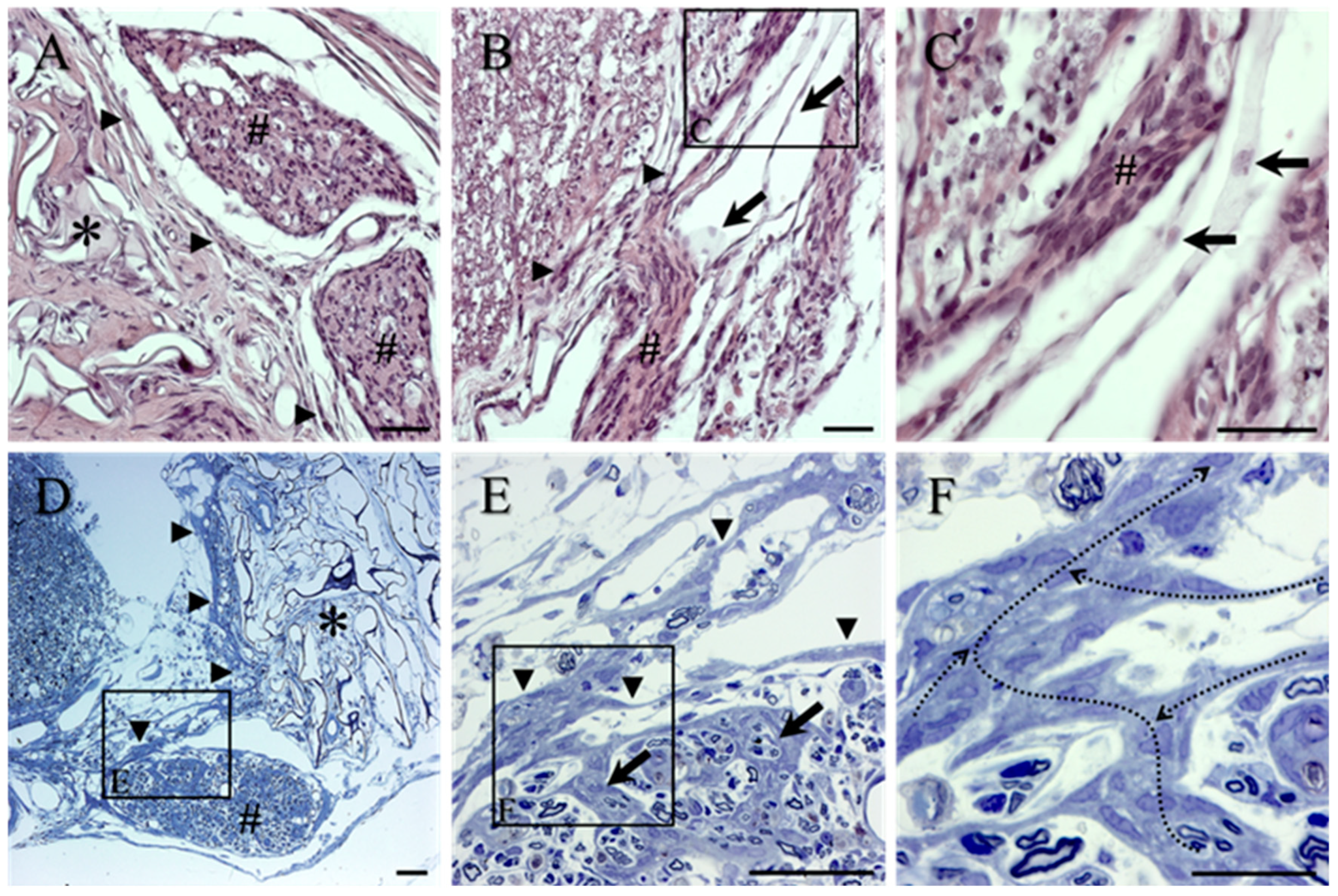Ijms 23 03221 g004 550