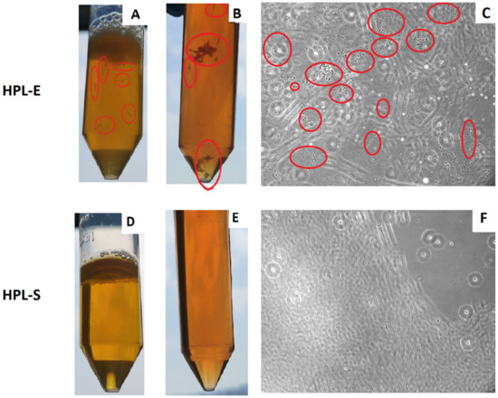 A New Human Platelet Lysate for Mesenchymal Stem Cell Production ...