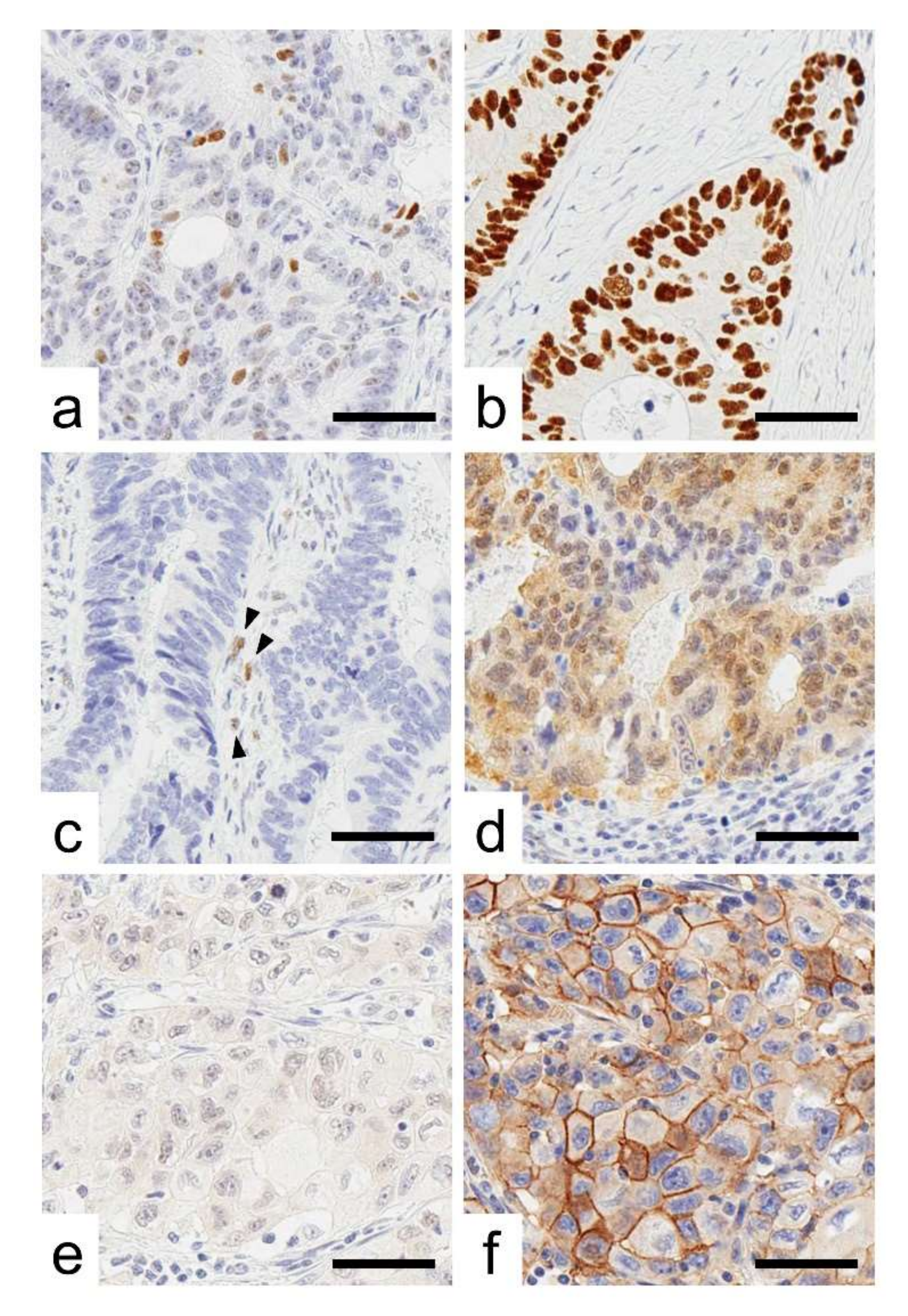 Ijms 23 03252 g001 550