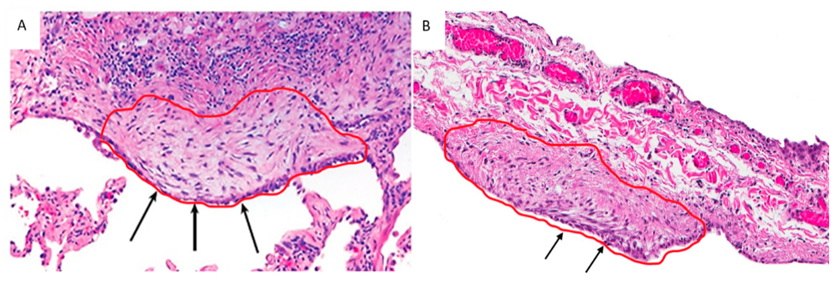 Ijms 23 03323 g001 550