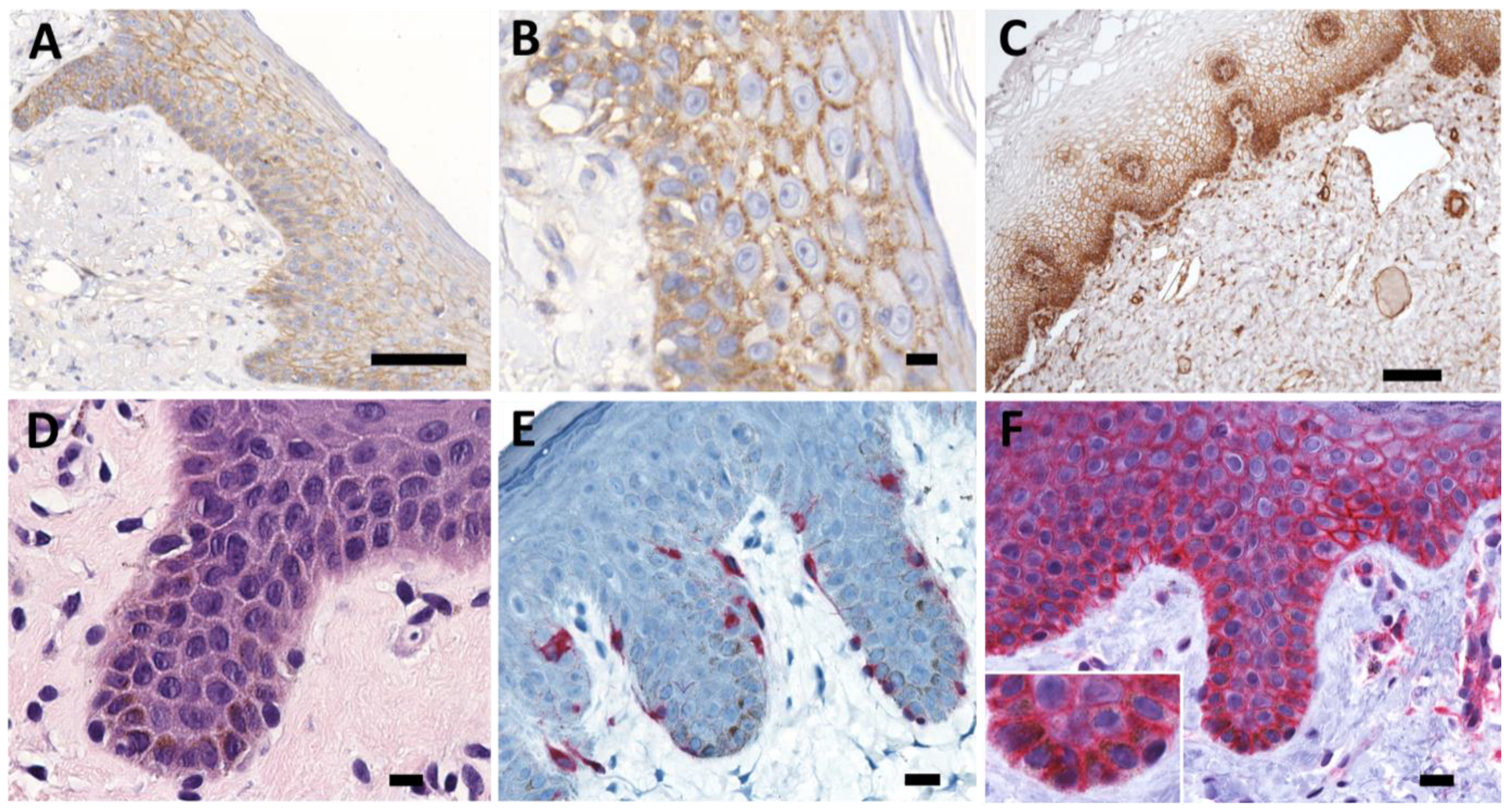 Ijms 23 03324 g001 550