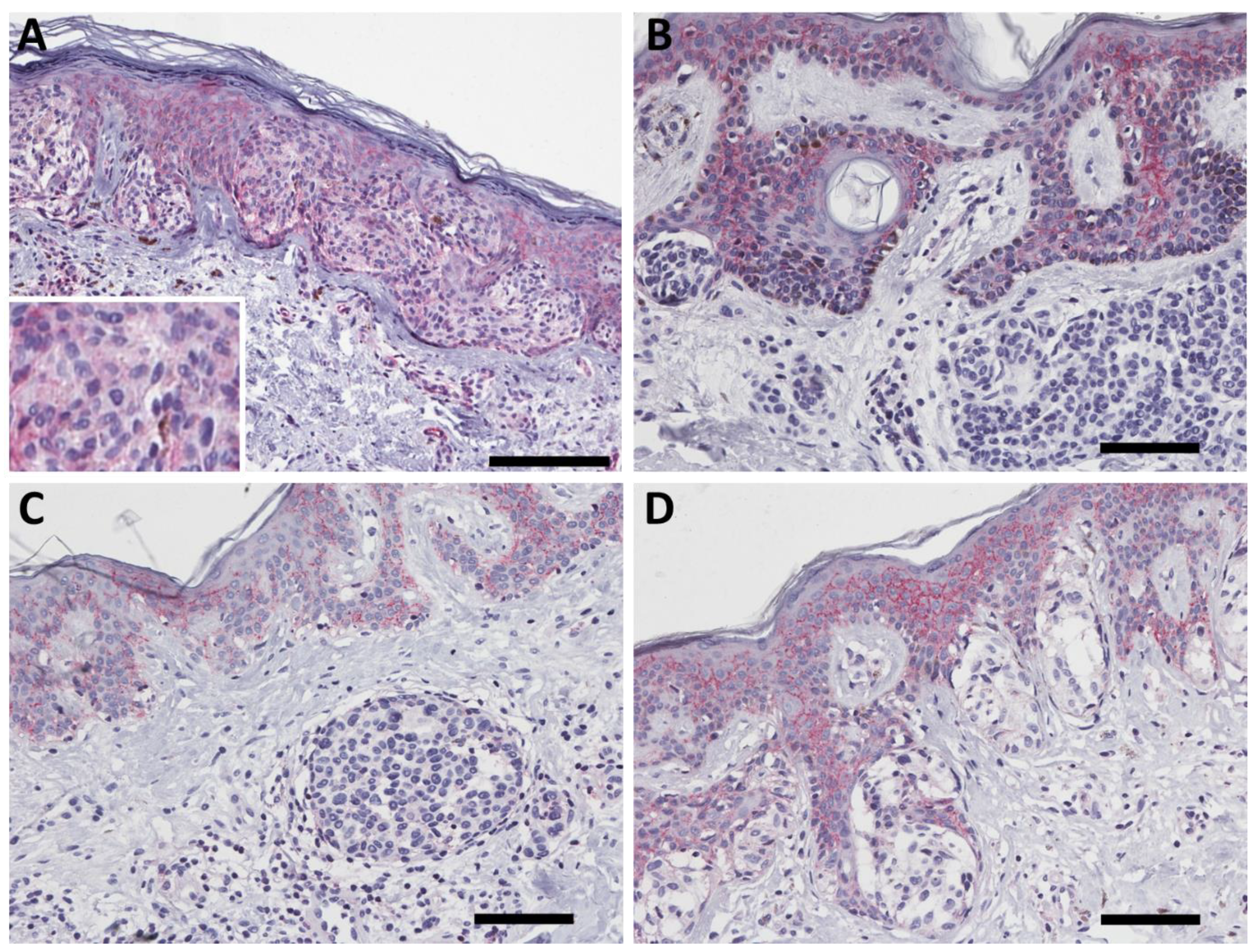 Ijms 23 03324 g002 550