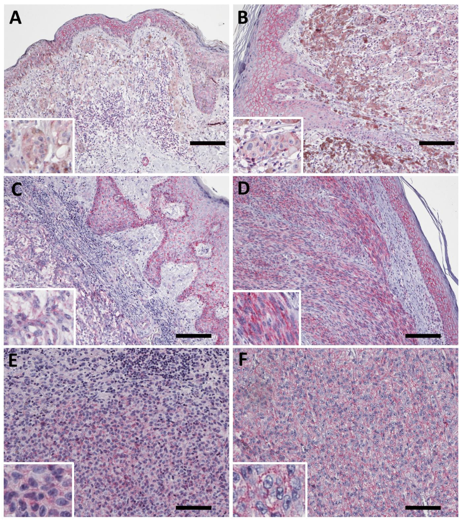 Ijms 23 03324 g003 550