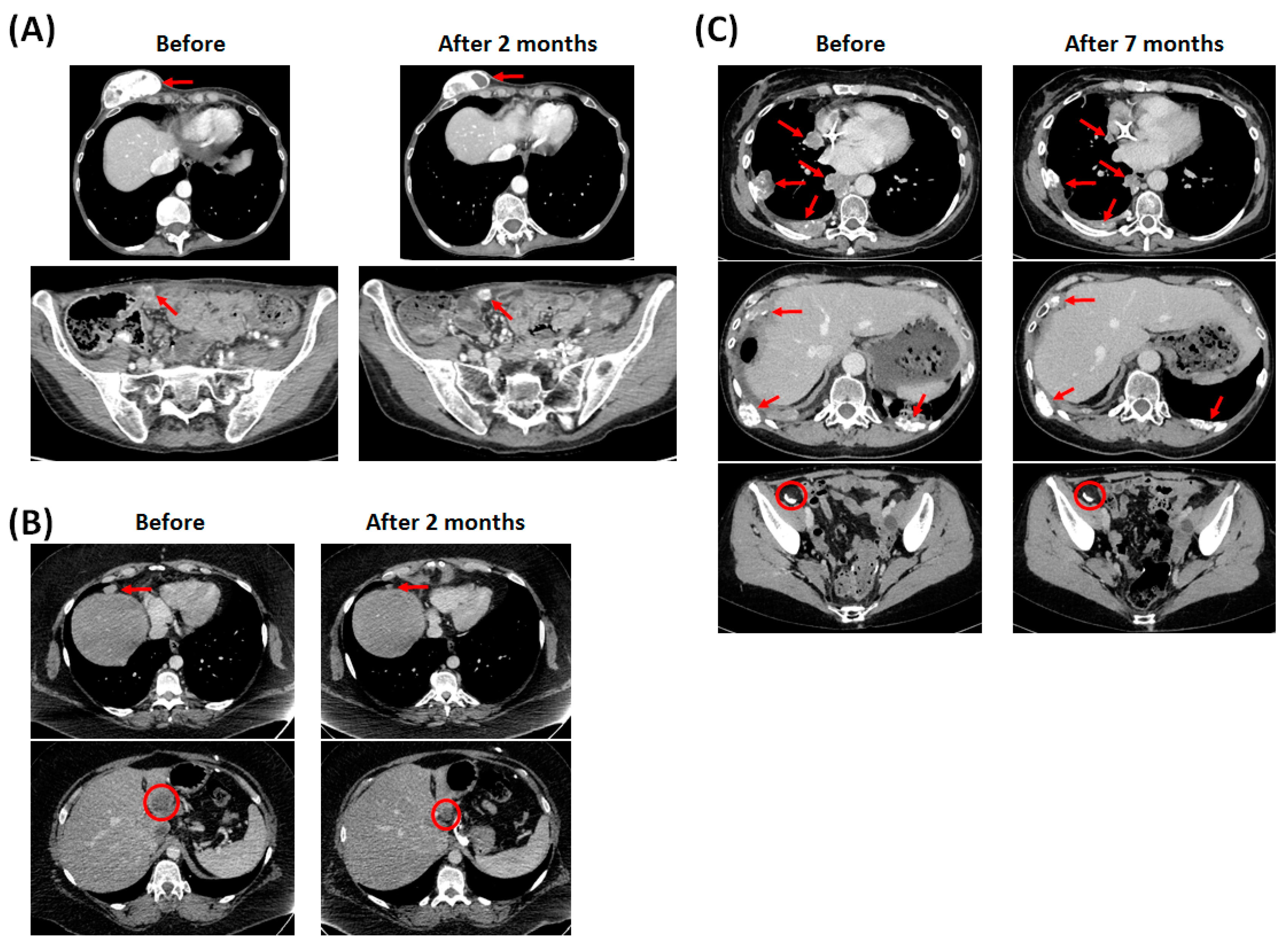 Ijms 23 03343 g001 550