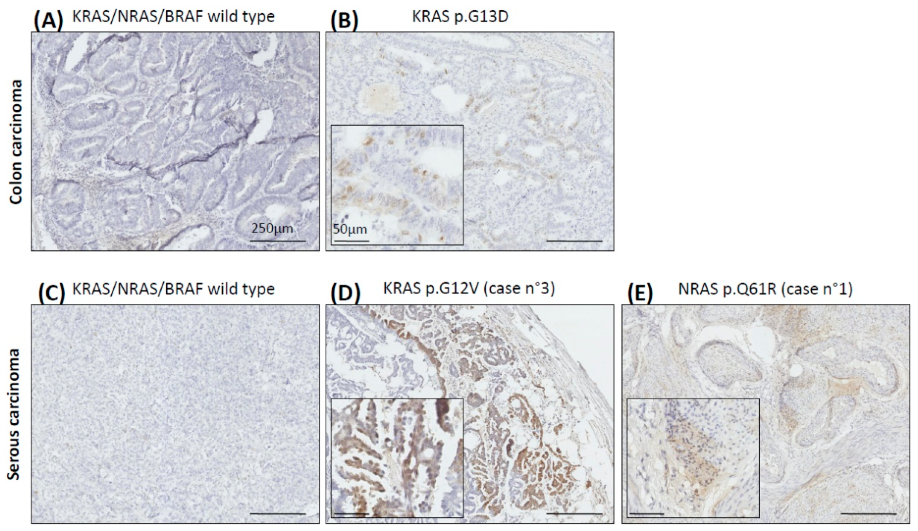 Ijms 23 03343 g003 550