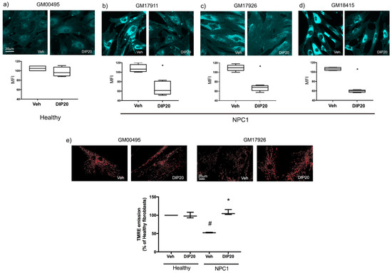 Fig 2.  Subcortical Volumetric Reductions in Adult Niemann-Pick