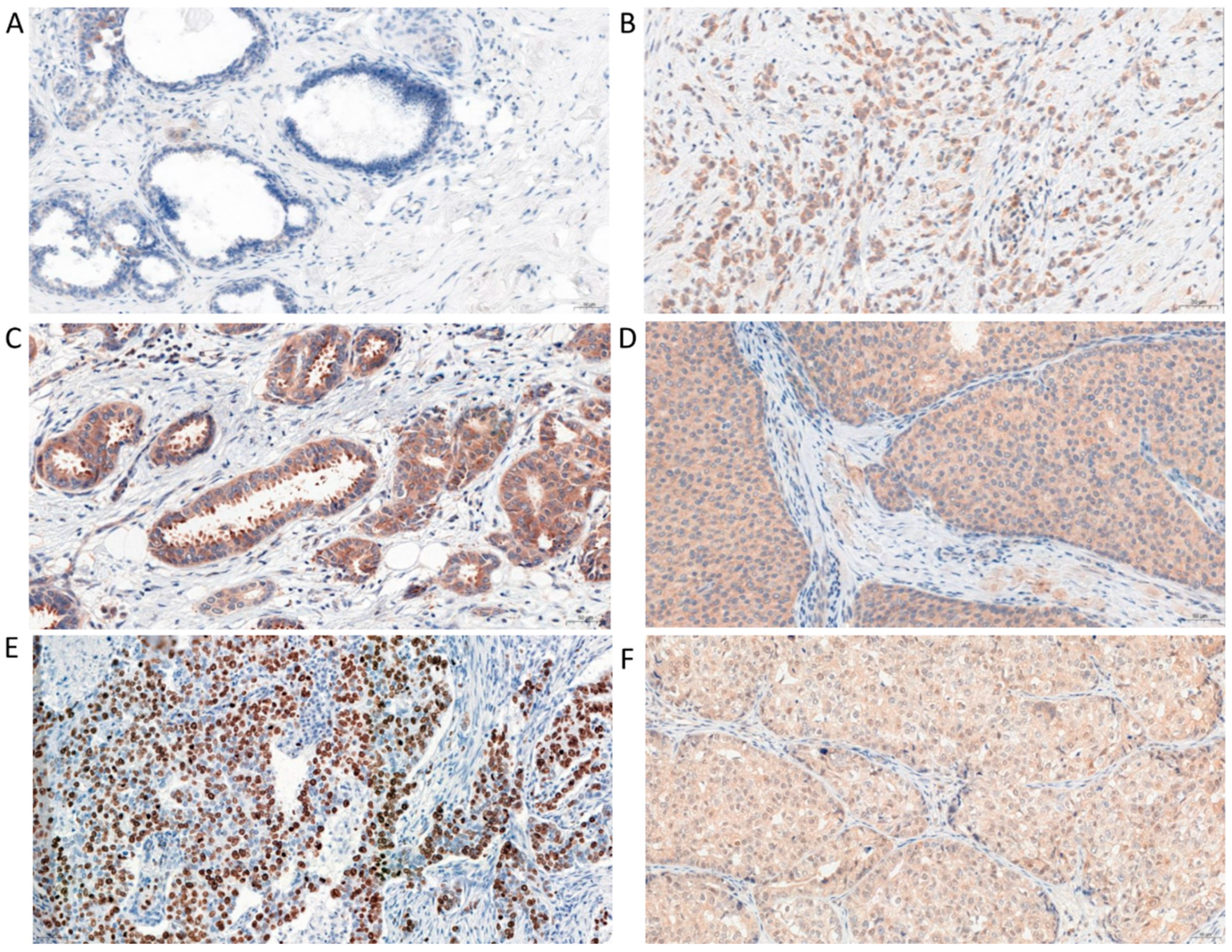 Ijms 23 03530 g001 550