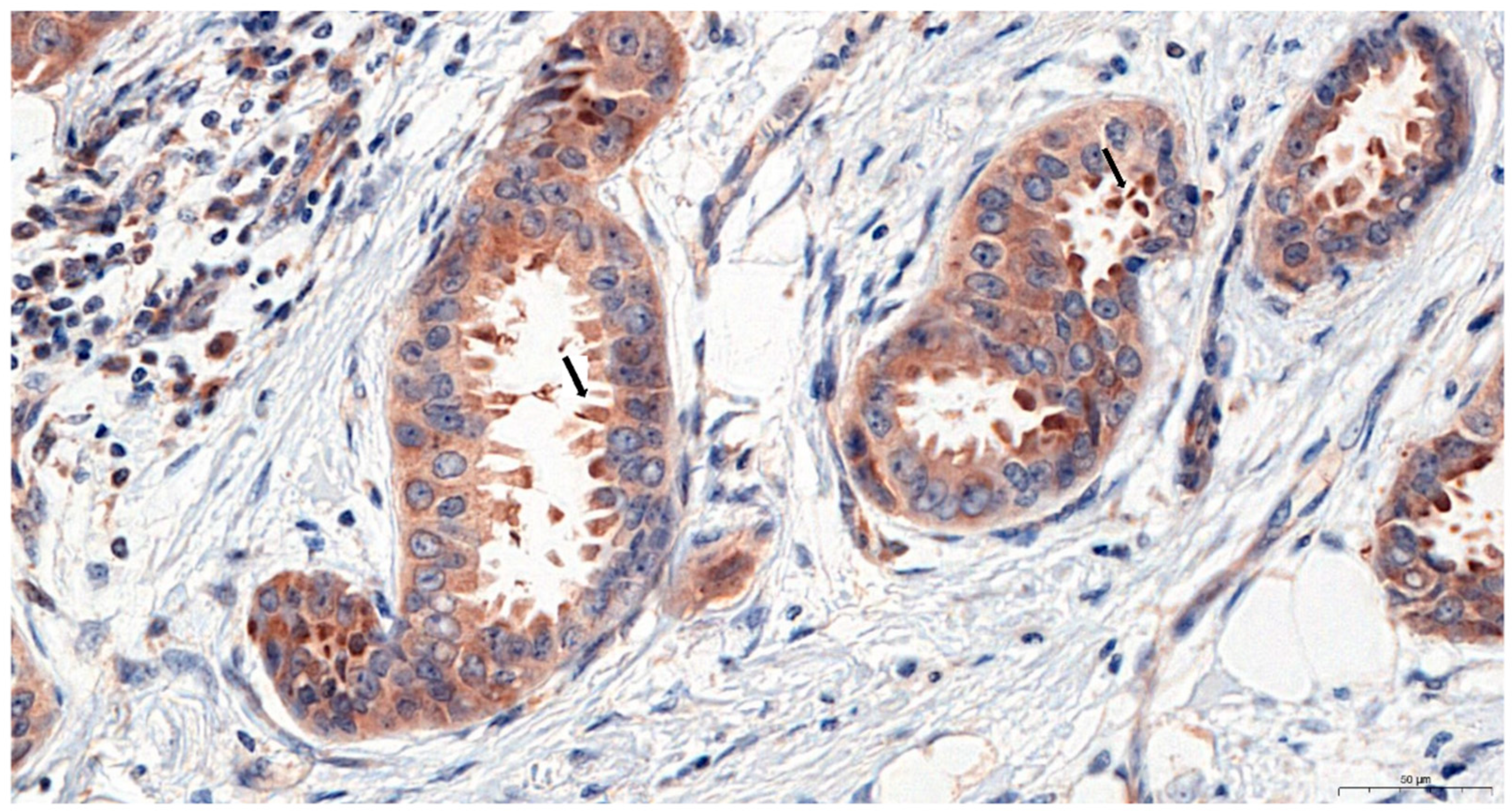 Ijms 23 03530 g002 550