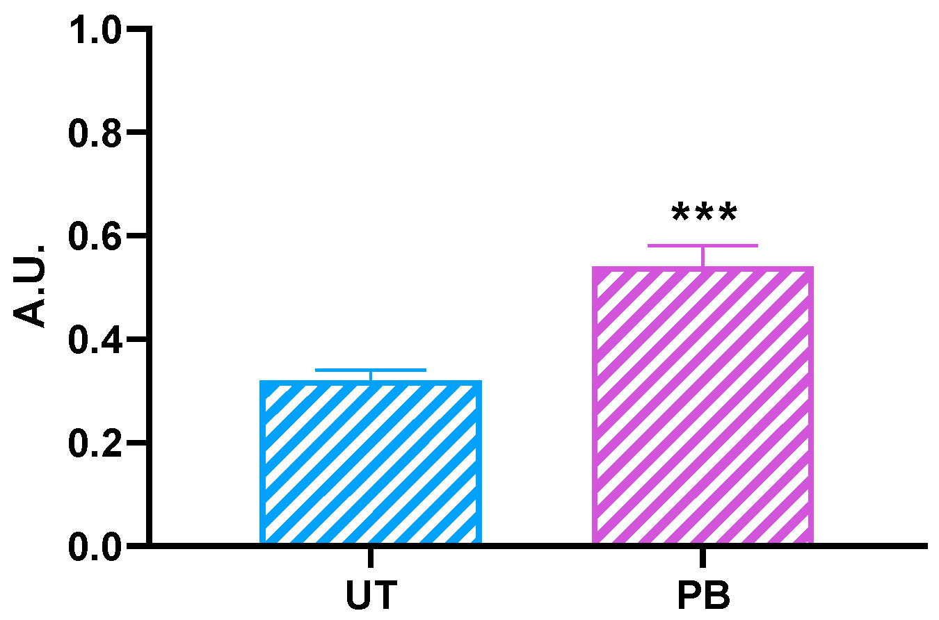 Ijms Free Full Text Induction By Phenobarbital Of Phase I And Ii Xenobiotic Metabolizing Enzymes In Bovine Liver An Overall Catalytic And Immunochemical Characterization Html