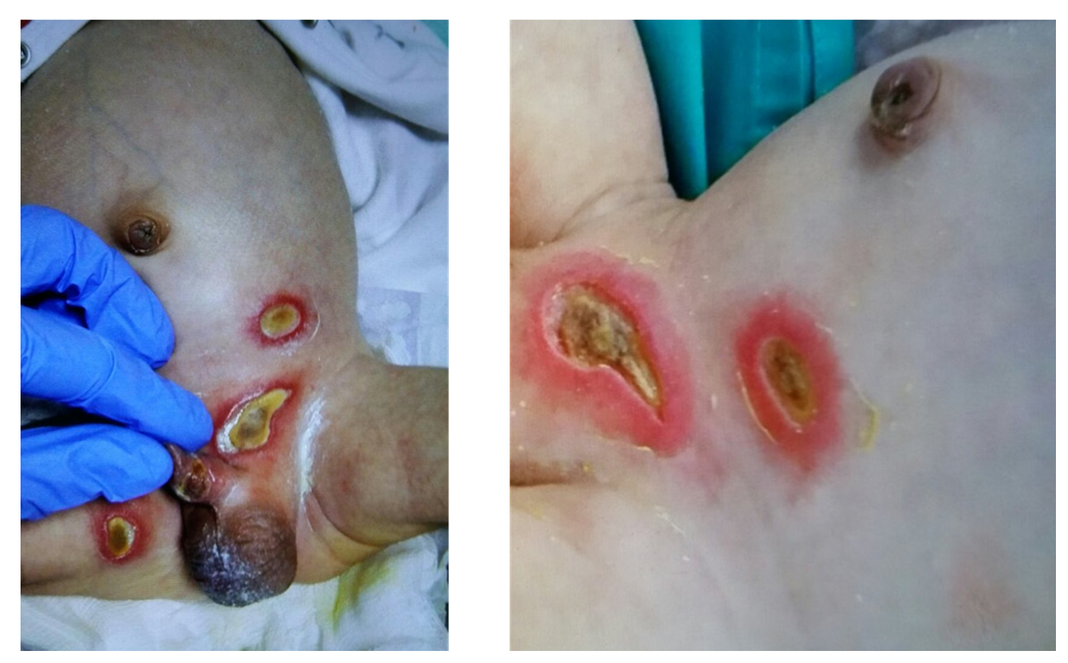 Ijms 23 03578 g002 550