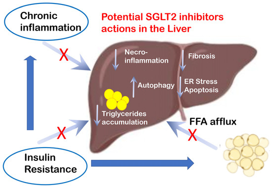 SGLT2 Inhibitors as the Most Promising Influencers on the Outcome of ...