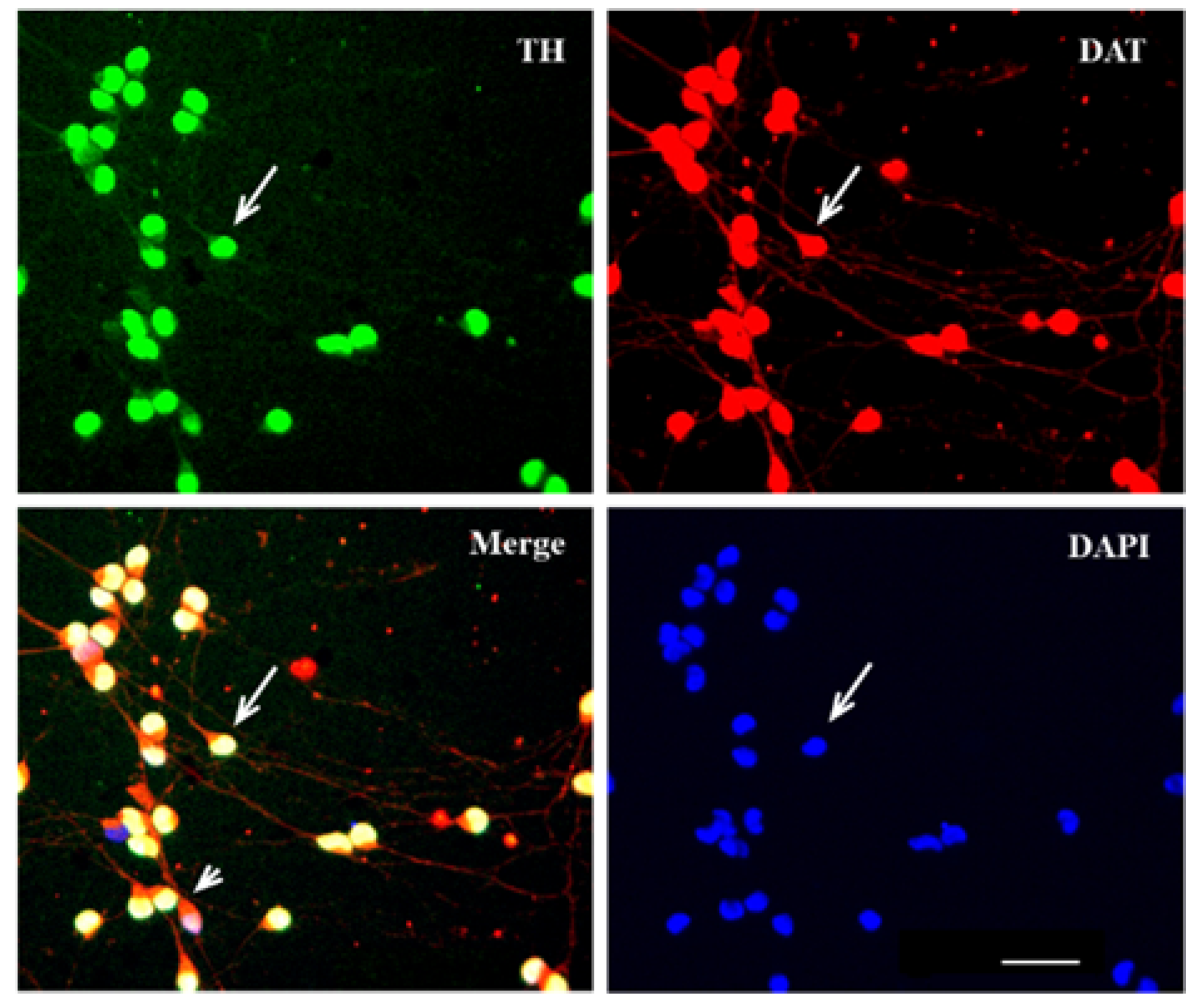 Ijms 23 03678 g004 550