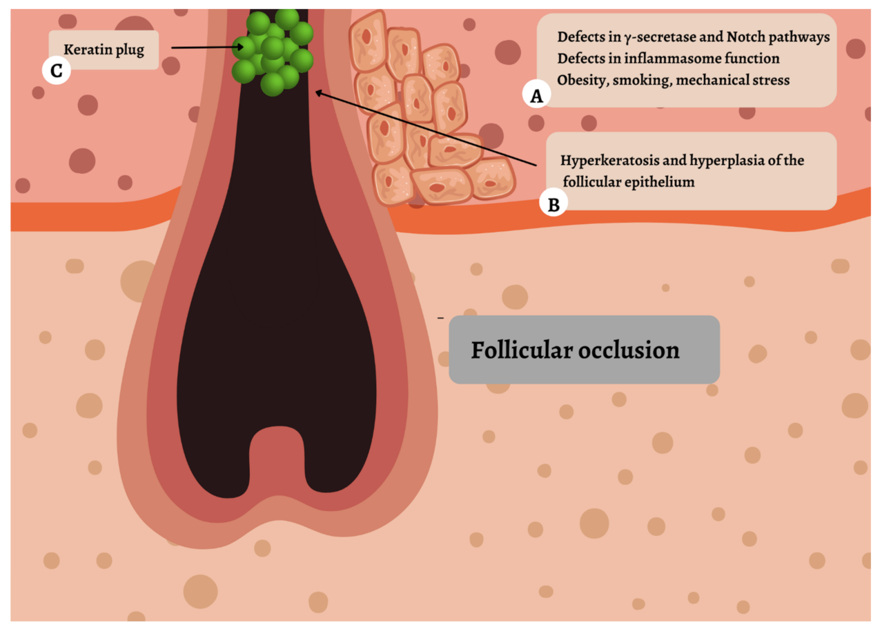 IJMS Free FullText New and Emerging Targeted Therapies for
