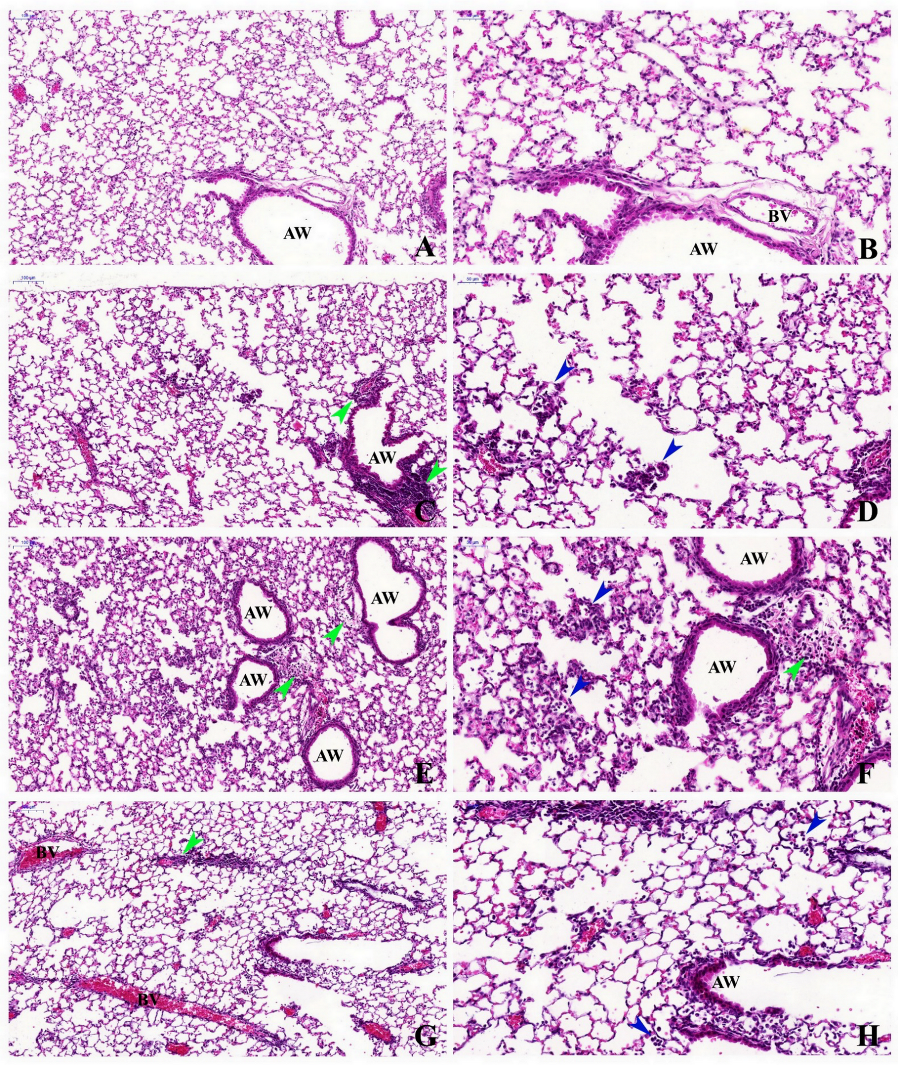 Ijms 23 03913 g001 550