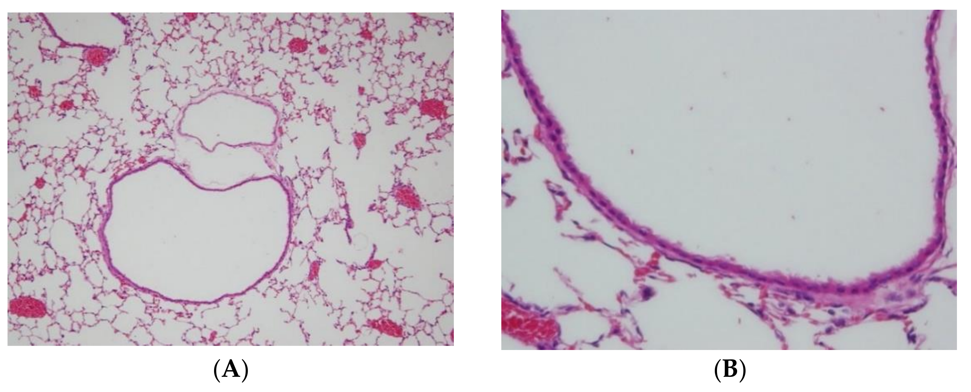 Ijms 23 04011 g002a 550