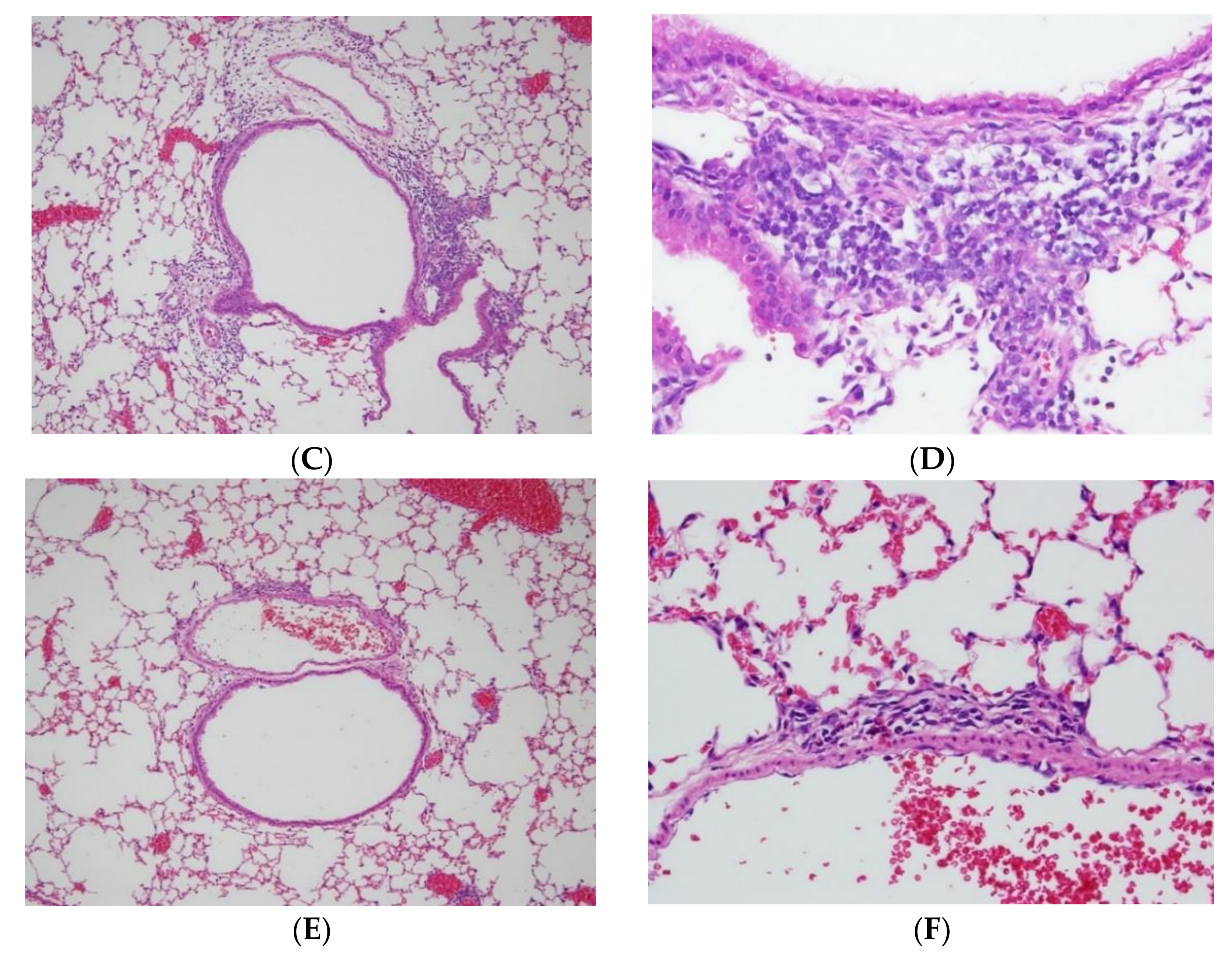 Ijms 23 04011 g002b 550