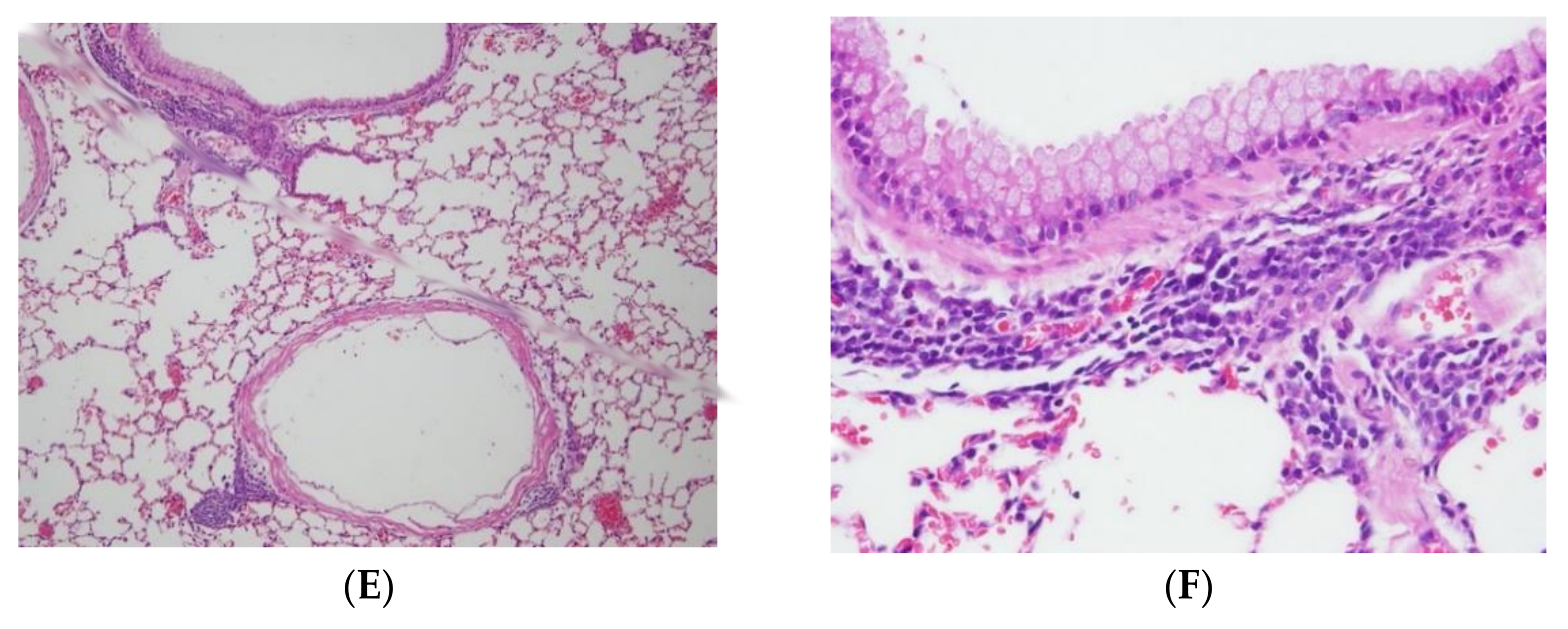 Ijms 23 04011 g003b 550