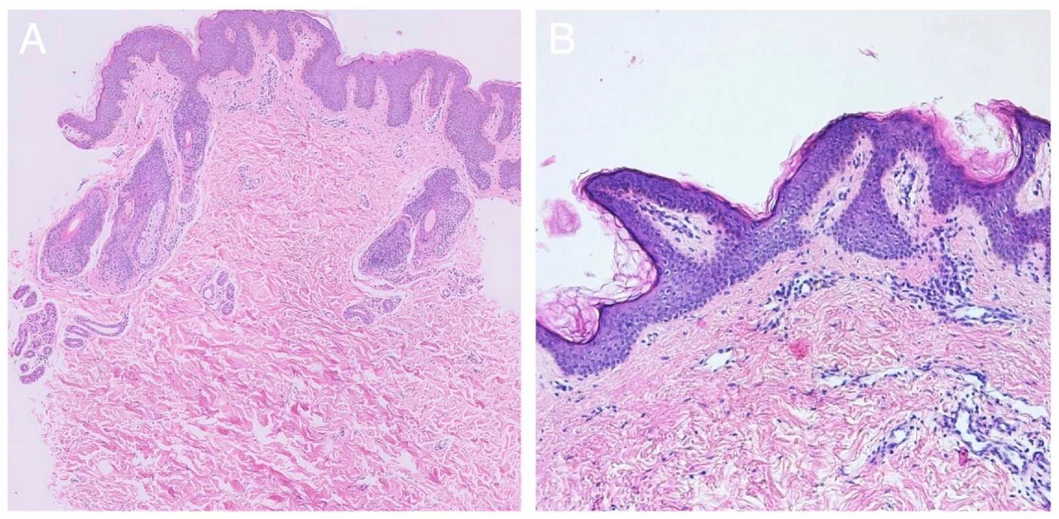 Ijms 23 04036 g002a 550