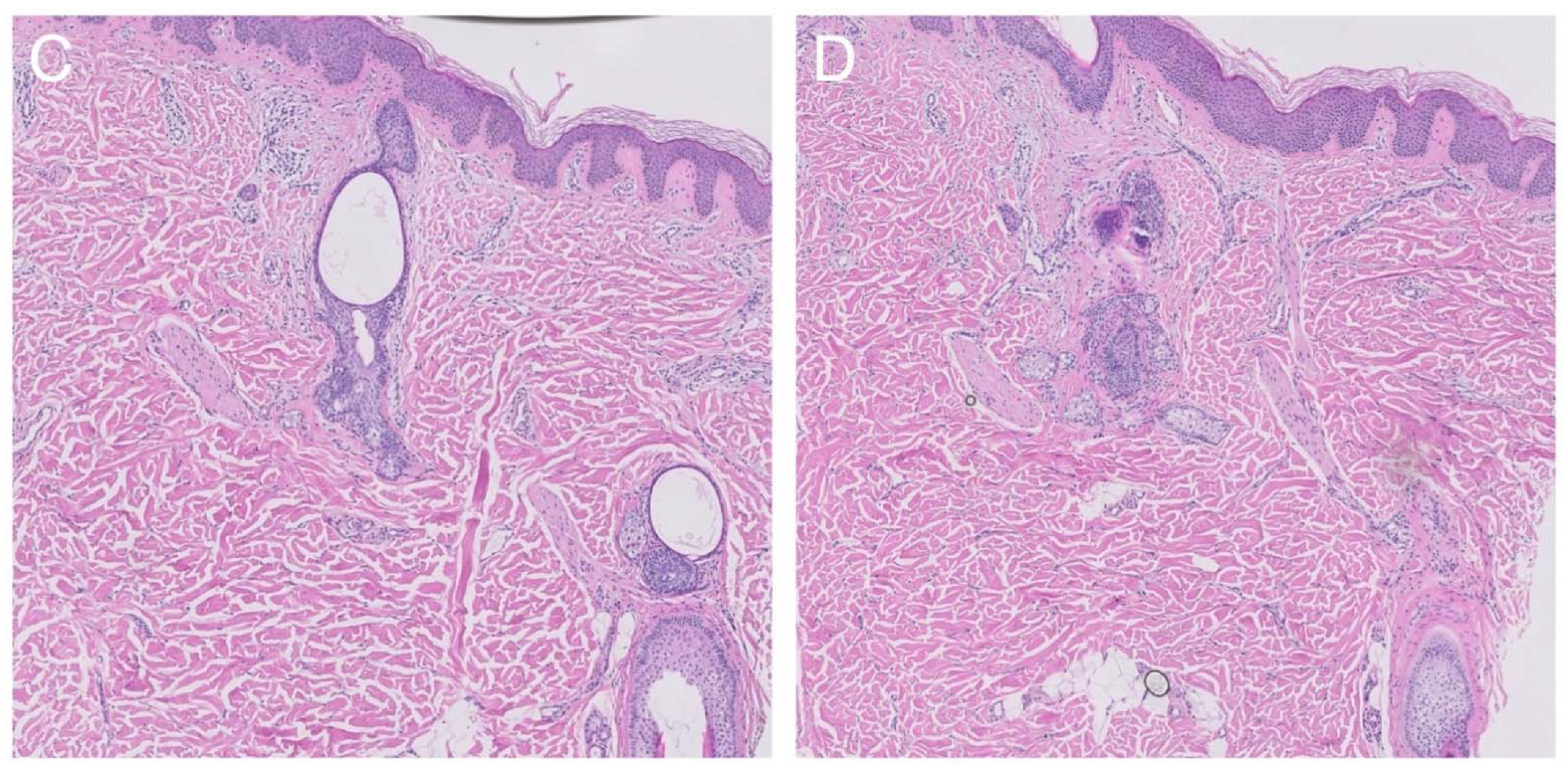 Ijms 23 04036 g002b 550