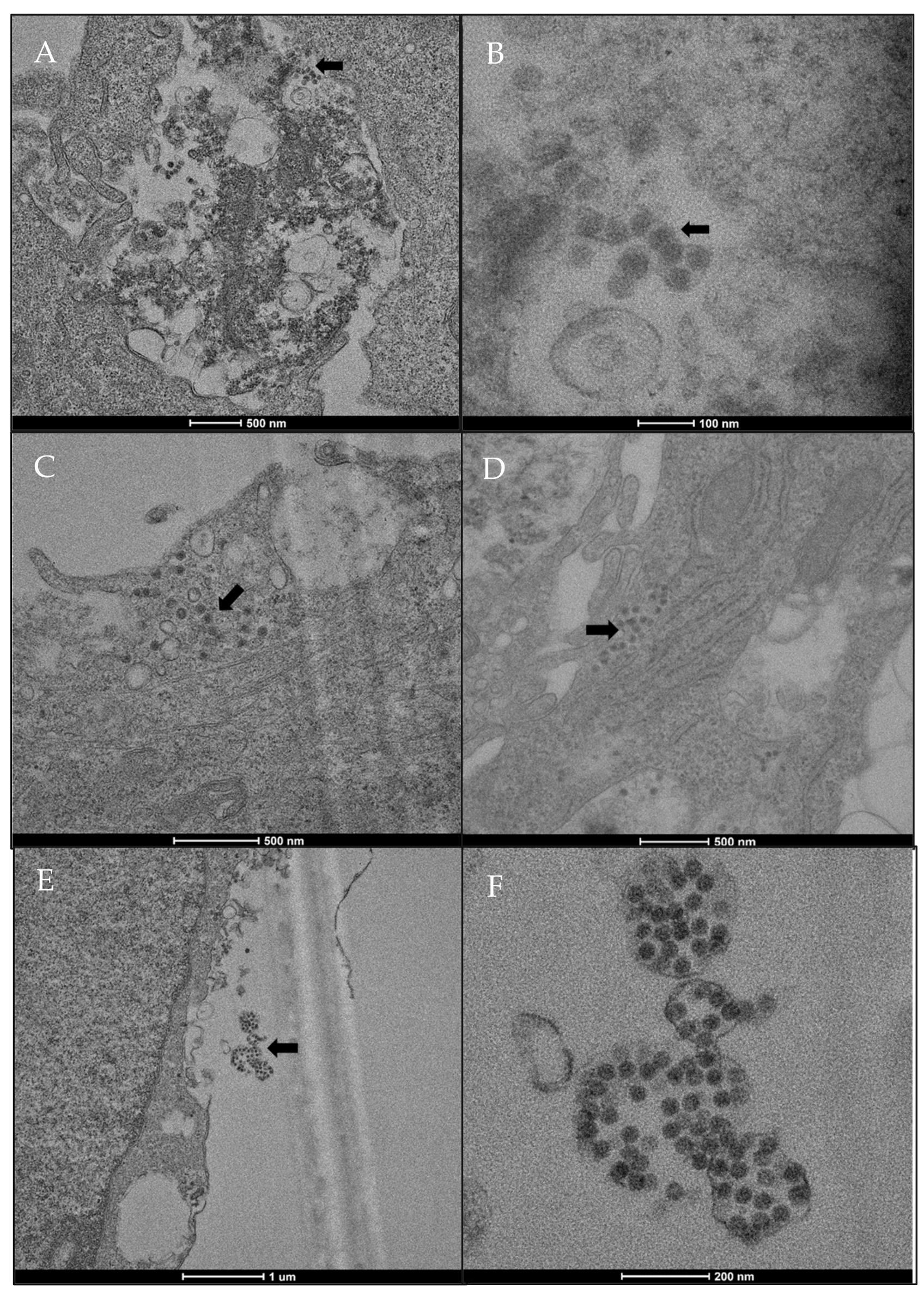 Ijms 23 04063 g004 Ijms 23 04063 g004