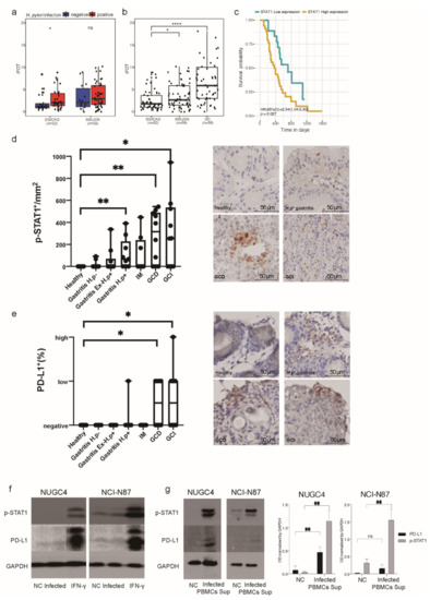 ＪＴ Alterations of the p16-pRb Pathway and the Chromosome Locus