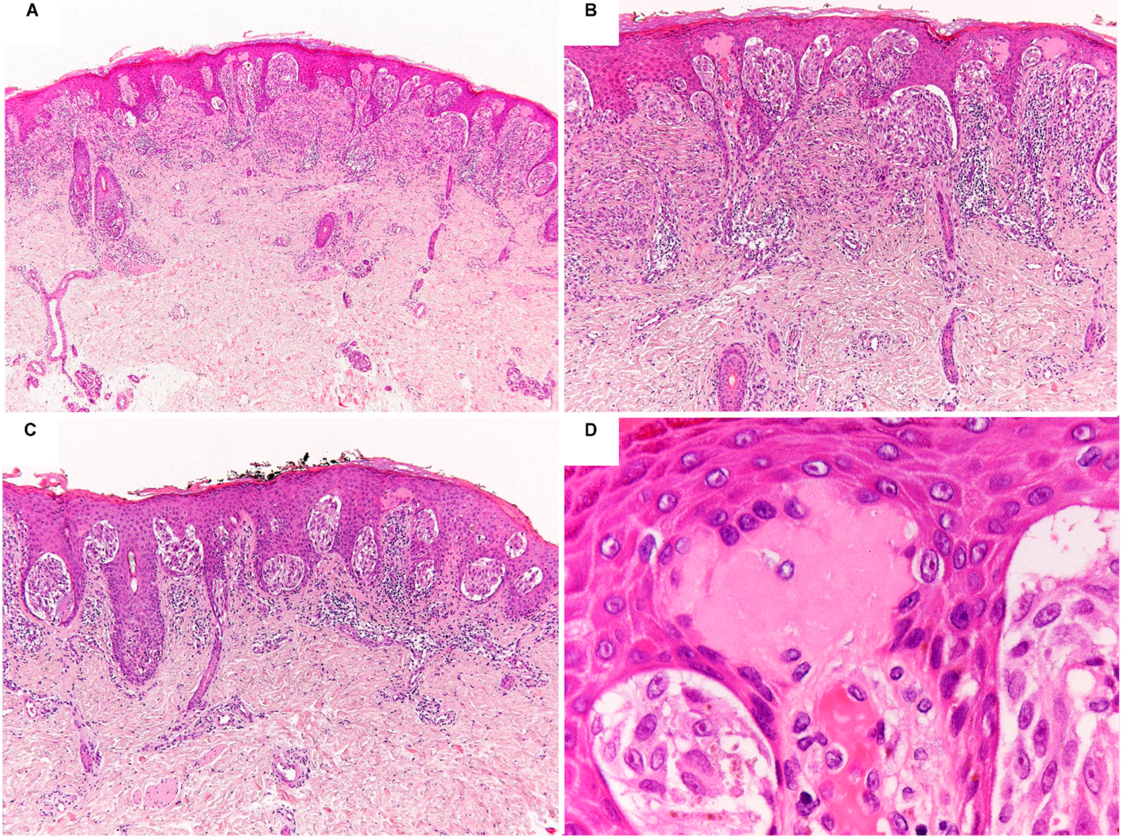 Ijms 23 04211 g001 550