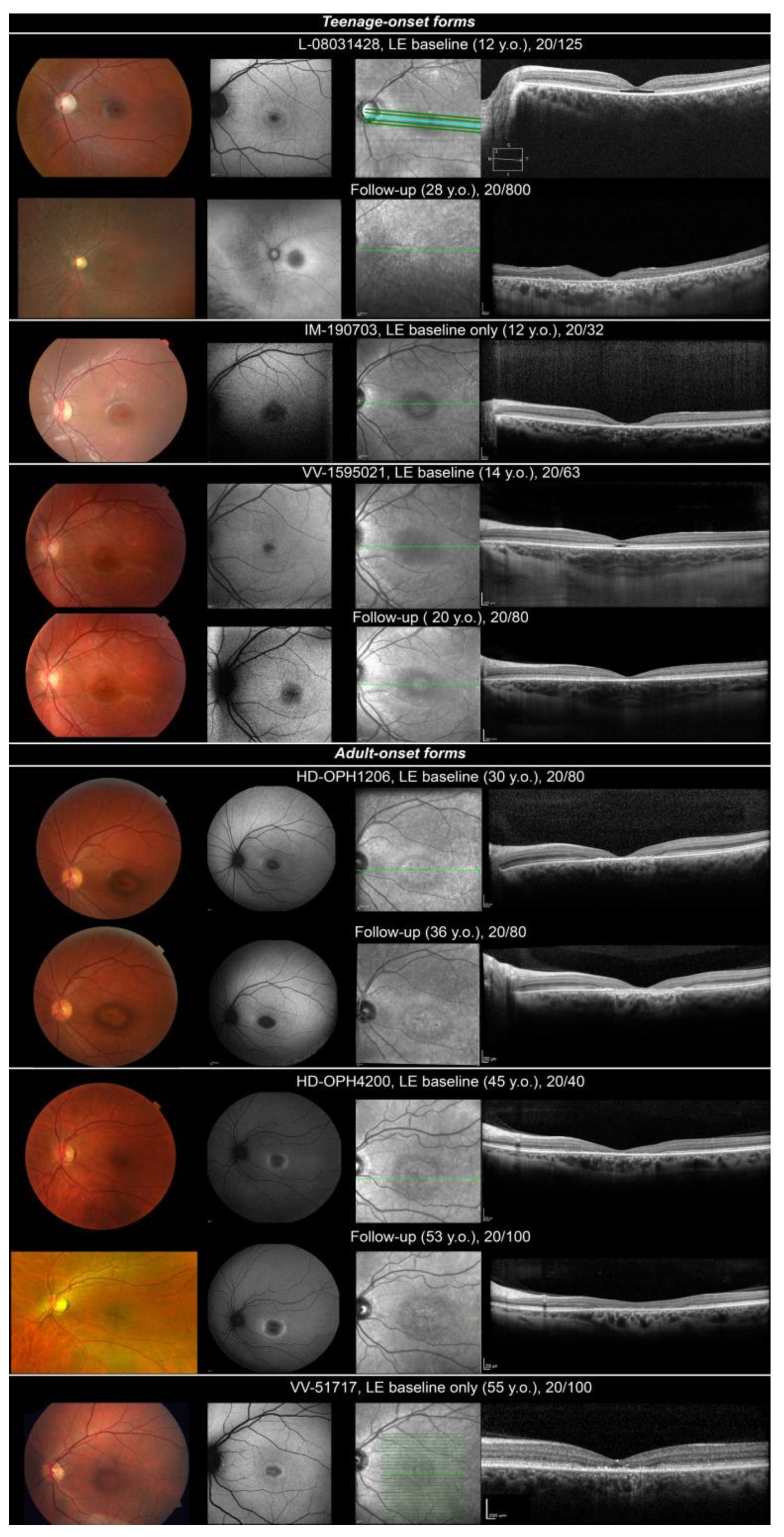 Ijms 23 04294 g001 550