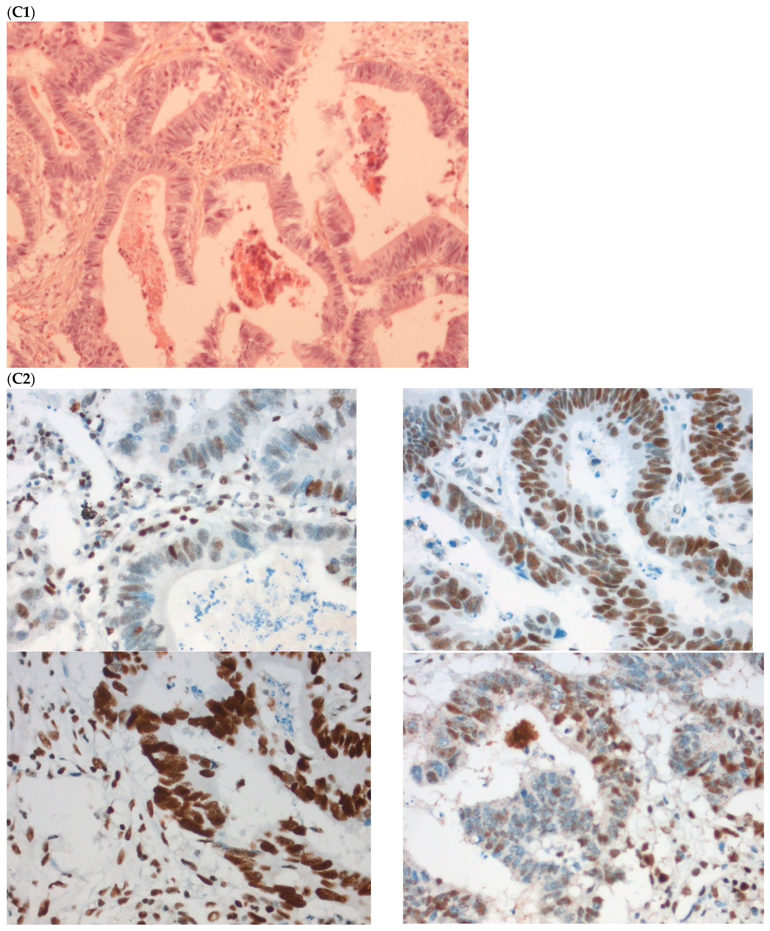 Ijms 23 04427 g002c 550