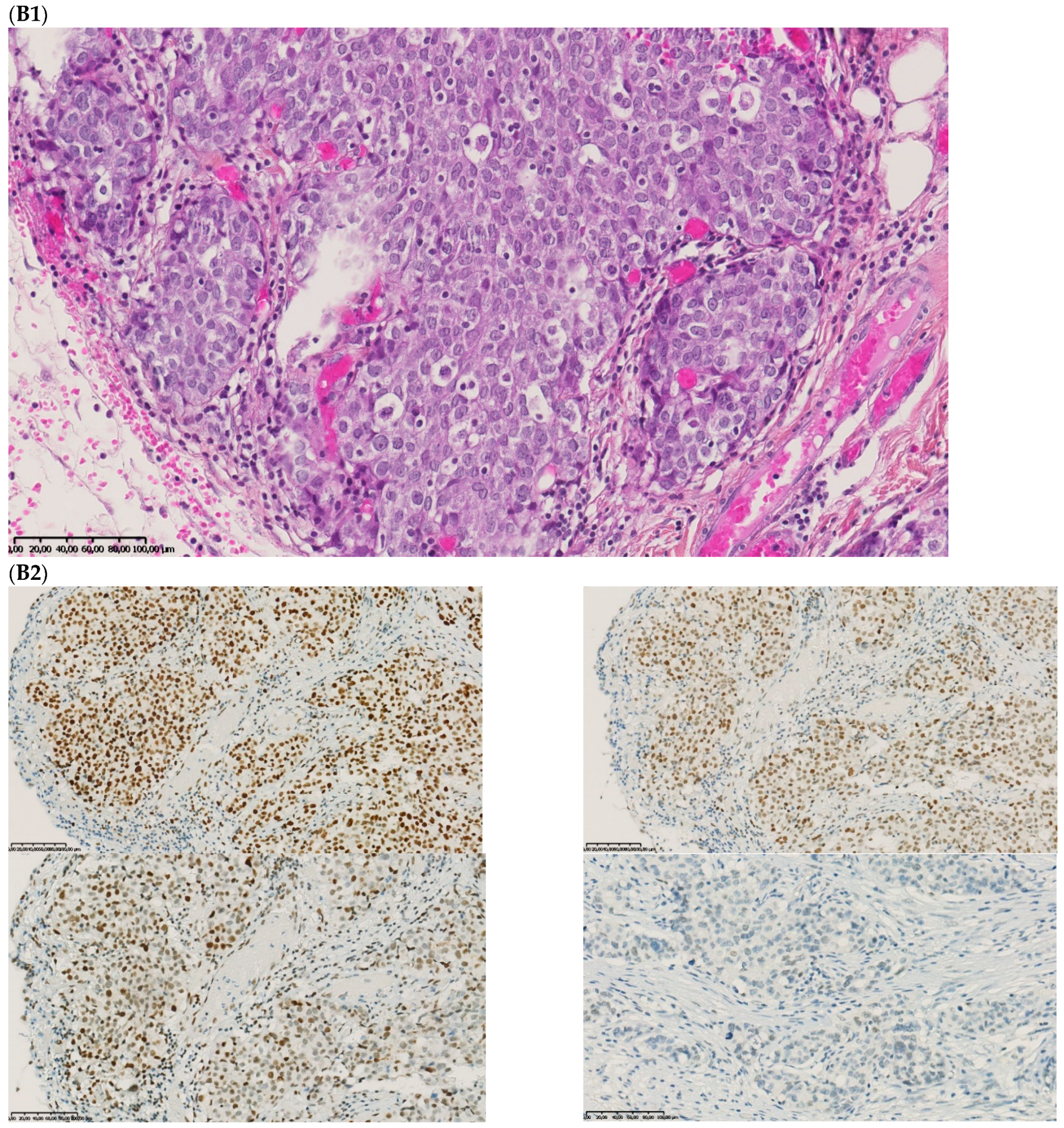 Ijms 23 04427 g003b 550