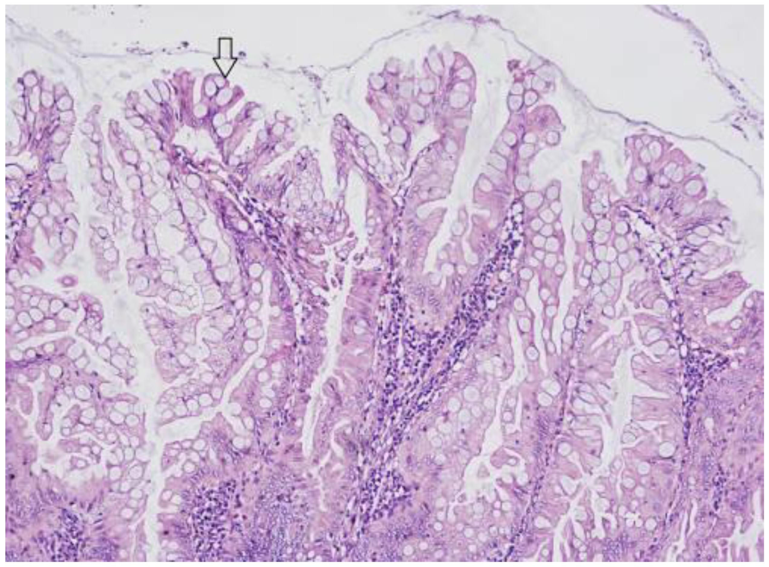 Ijms 23 04461 g001 Ijms 23 04461 g001