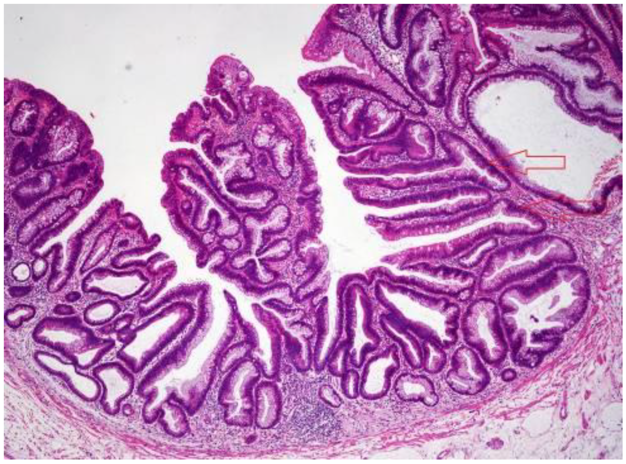 Ijms 23 04461 g002 Ijms 23 04461 g002