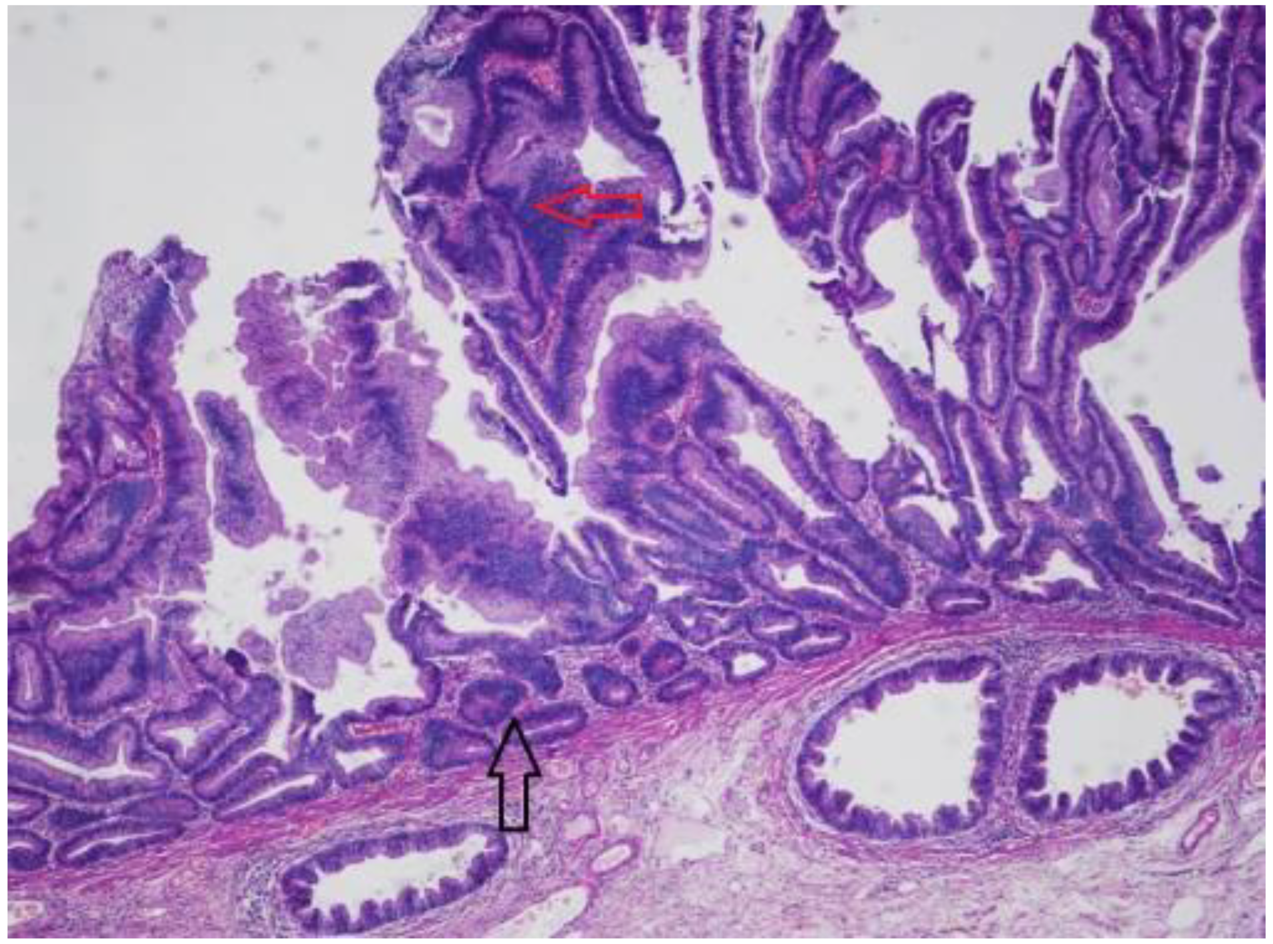 Ijms 23 04461 g003 Ijms 23 04461 g003