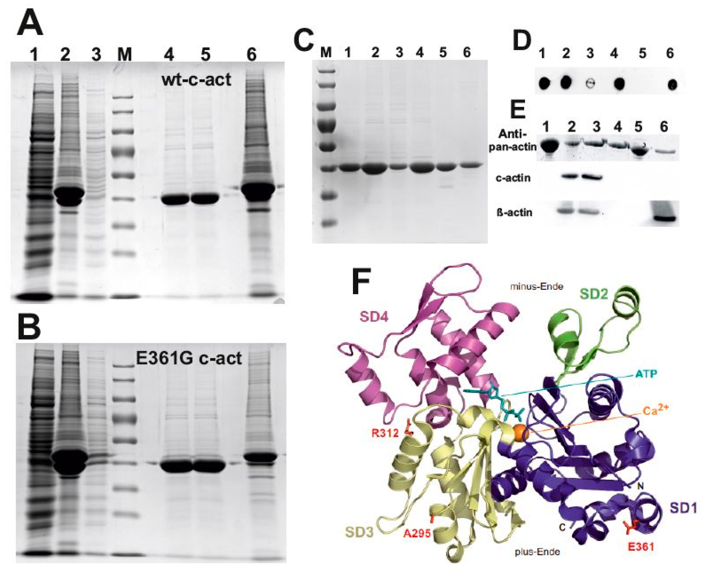 Functional Characterization of Cardiac Actin Mutants Causing
